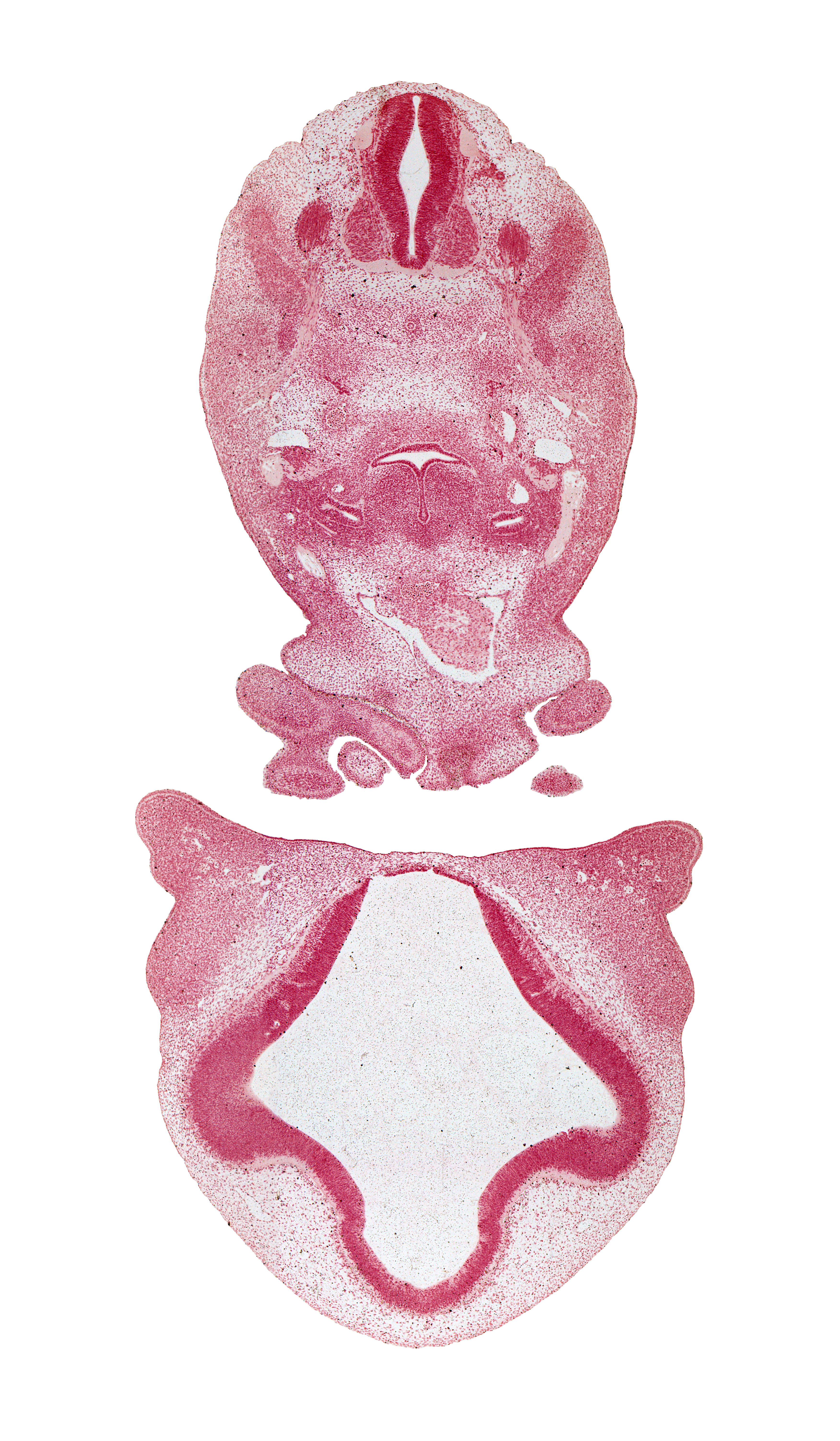 C-4 spinal ganglion, anterior cerebral artery, aortic arch 6, ascending aorta, dorsal aorta, edge of nasal sac epithelium, head mesenchyme, hypoglossal nerve (CN XII), interventricular foramen, junction of maxillary and medial nasal prominences, laryngeal pharynx, lateral ventricle, maxillary prominence of pharyngeal arch 1, medial nasal prominence(s), notochord, pharyngeal condensation, precardinal vein, primordial meninx, surface ectoderm, sympathetic trunk, third ventricle, torus hemisphericus, ultimopharyngeal pouch, vagus nerve (CN X), wall of truncus arteriosus (distal outflow tract)