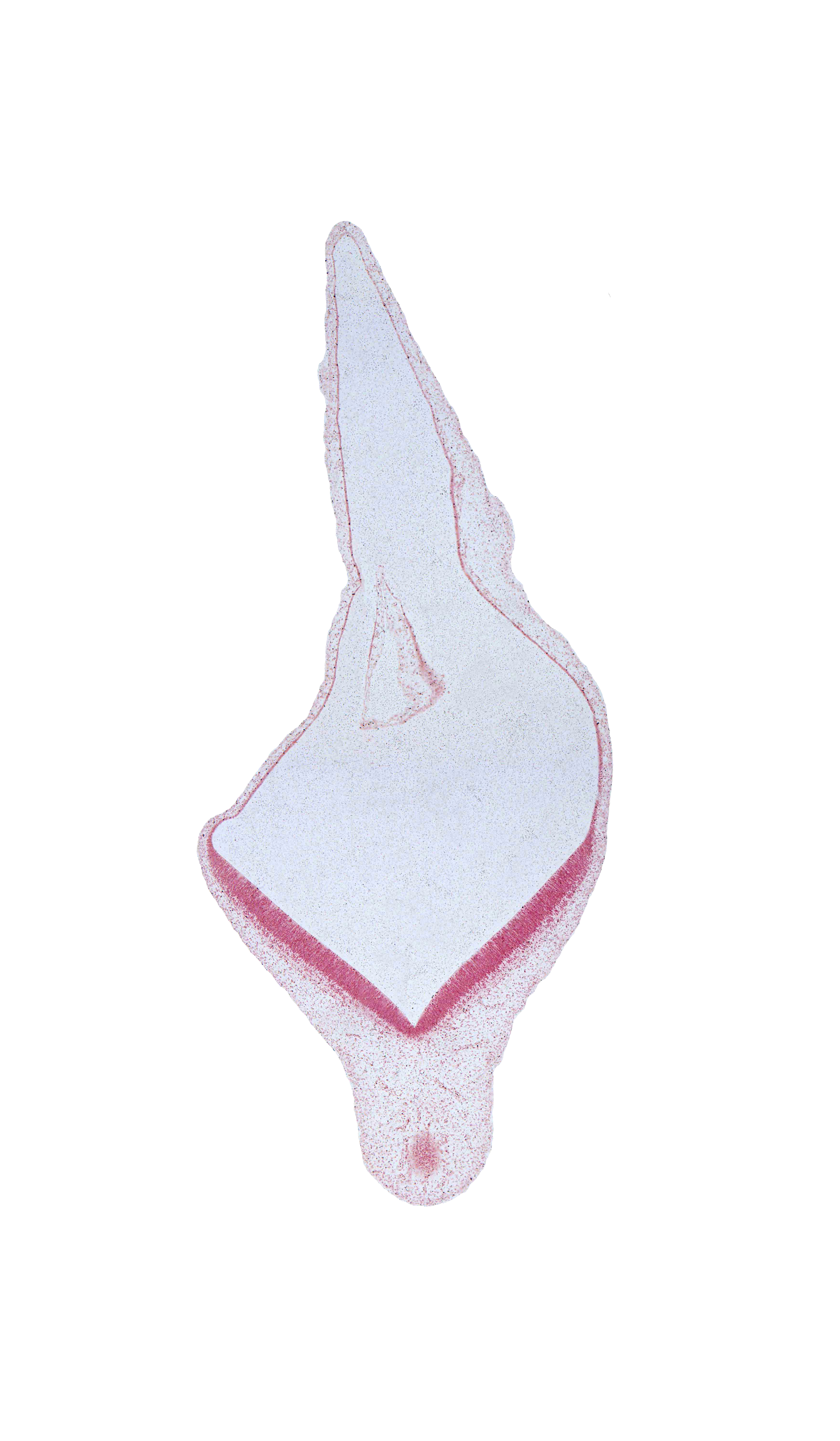 edge of mesencephalon, external space, head mesenchyme, rhombencoel (fourth ventricle), roof plate, surface ectoderm
