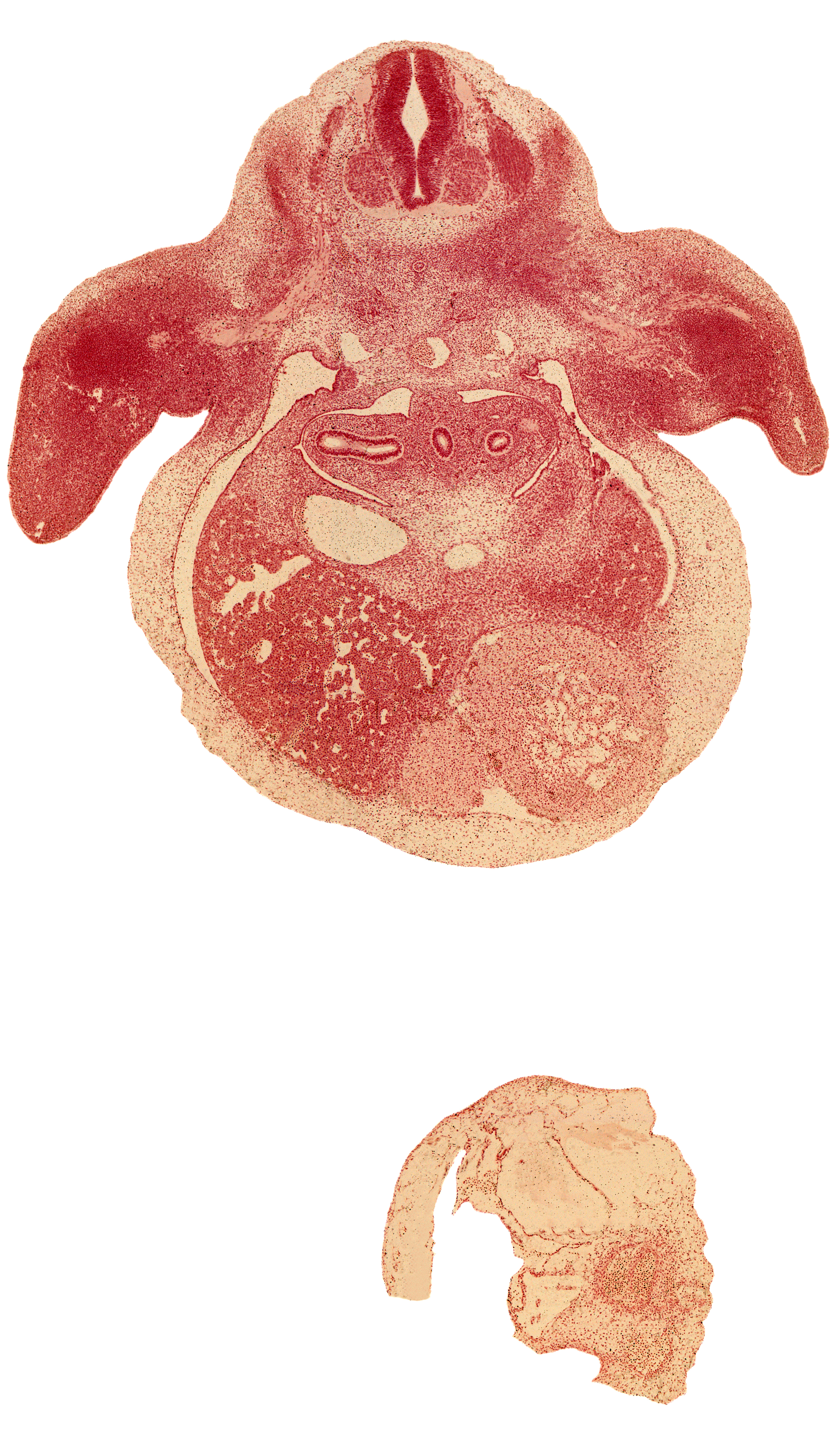 C-7 spinal ganglion, aorta, brachial plexus, central canal, edge of left lobe of liver, edge of pericardial cavity, esophagus, forearm, hepatic part of inferior vena cava, left ventricle, lower secondary bronchus bud, middle secondary bronchus bud, pericardial cavity, peritoneal cavity, postcardinal vein, primordial pleural cavity, radial nerve, right lobe of liver, right ventricle, skeletal blastema of humerus, sympathetic trunk