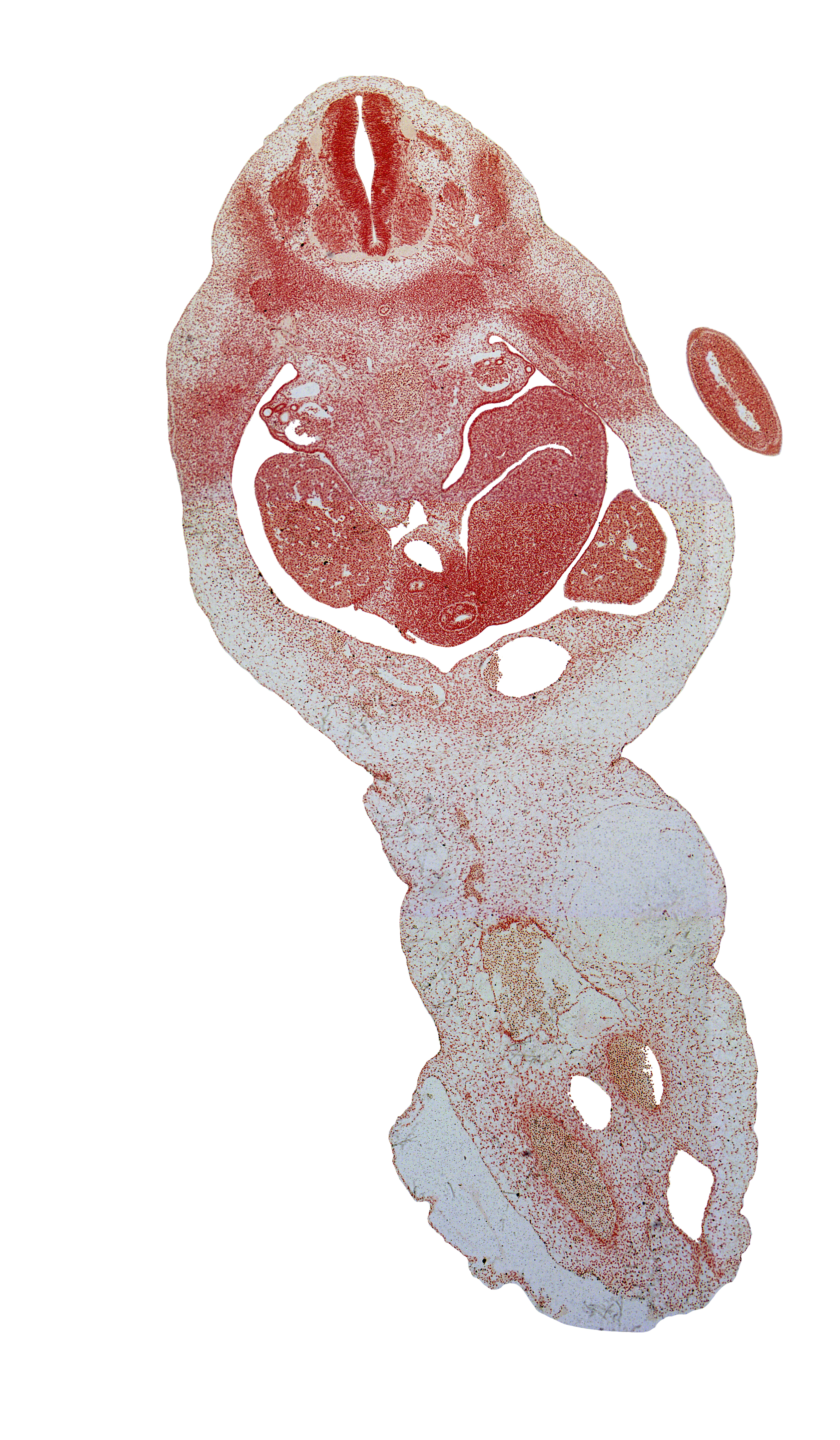 T-2 dorsal root, T-3 spinal nerve, T-3 ventral root, blastema of rib 4, cephalic edge of T-3 spinal ganglion, dorsal mesogastrium, duodenum, hepatic portal vein, left lobe of liver, left umbilical artery, lesser sac (omental bursa), marginal vein, mesonephric duct, neural arch, postcardinal vein, right lobe of liver, right umbilical artery, roof plate, spleen, umbilical cord, umbilical vein