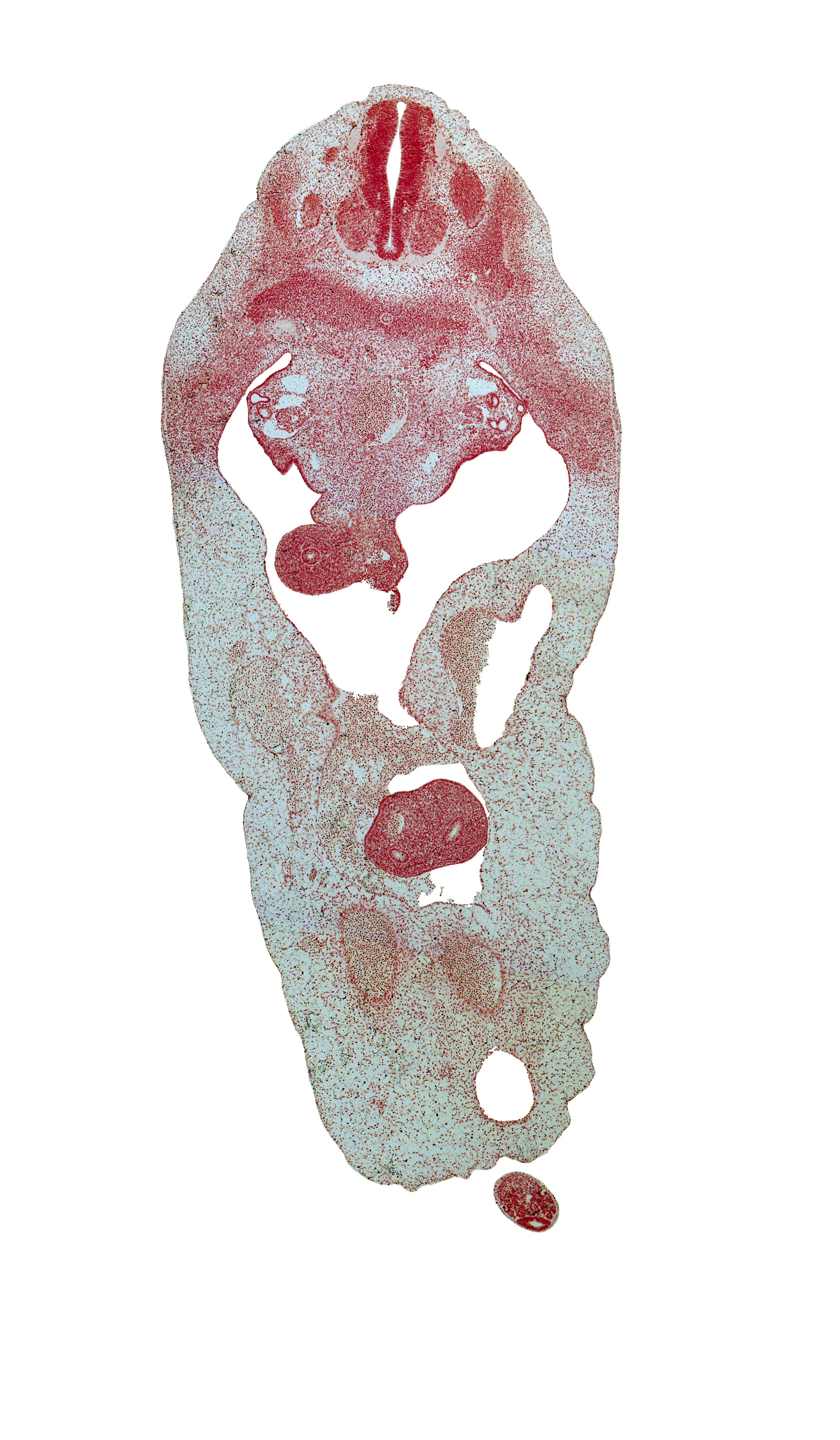 T-4 spinal ganglion, T-5 spinal nerve, allantois, aorta, celiac plexus, cephalic edge of gonadal ridge, distal limb of herniated midgut, duodenum, left umbilical artery, neural arch, peritoneal cavity, postcardinal vein, proximal limb of herniated midgut, right umbilical artery, subcardinal vein, superior mesenteric vessels, umbilical coelom, umbilical vein