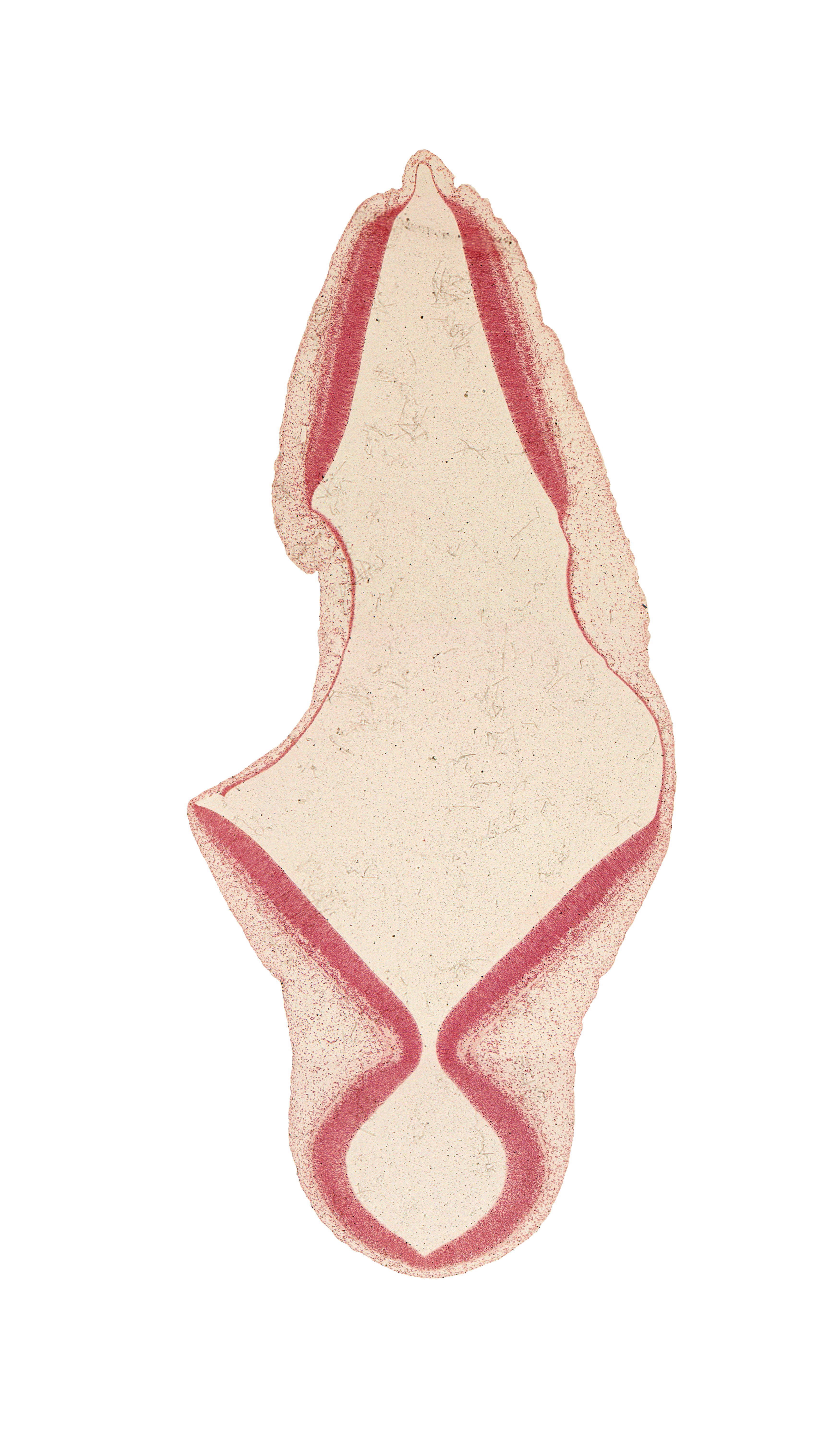 alar plate of myelencephalon, artifact separation(s), head mesenchyme, intermediate zone, isthmus of rhombencephalon, mesencoel, rhombencoel (fourth ventricle), roof plate of rhombencephalon, trochlear nerve (CN IV), ventricular zone