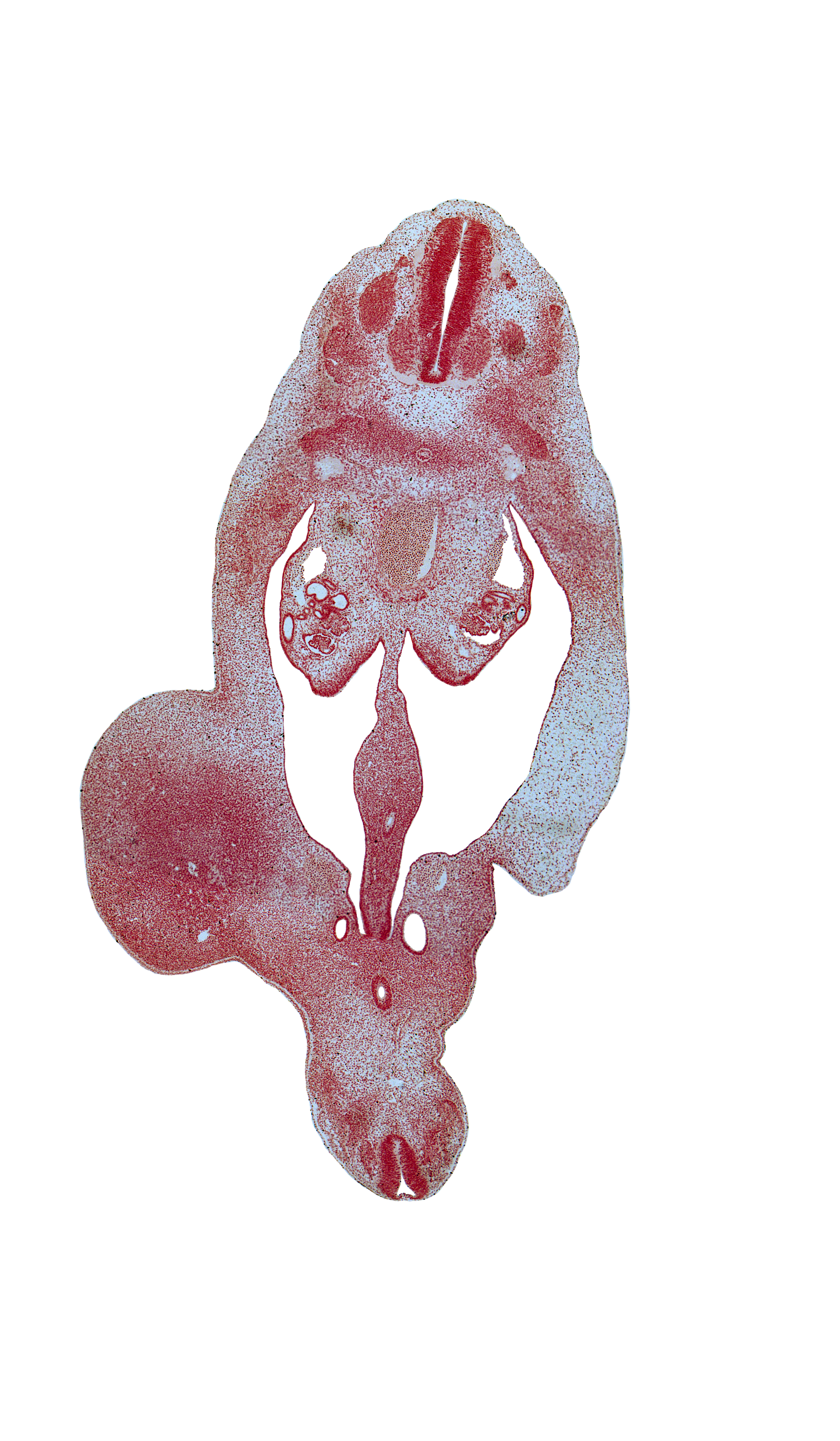 T-7 spinal ganglion, T-8 spinal ganglion, aorta, blastema of rib 9, coccygeal mesoderm, dorsal mesentery, gonadal ridge, hindgut, horn of urogenital sinus, mesonephric duct, notochord, peritoneal cavity, postcardinal vein, rectum