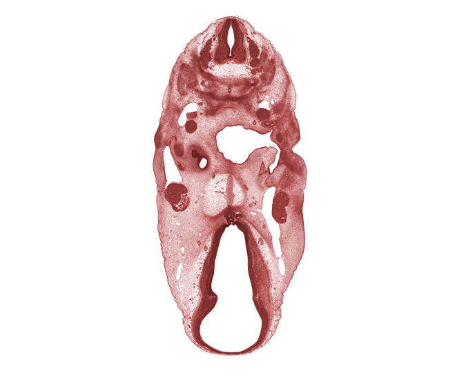 C-3 spinal ganglion, C-3 spinal nerve, C-4 spinal ganglion, basilar artery, cervical plexus, dorsal thalamus, edge of cochlear duct, facial nerve (CN VII), geniculate ganglion (CN VII), hypothalamus, inferior ganglion of vagus nerve (CN X), infundibular recess, internal carotid artery, marginal ridge, middle sulcus, motor root of trigeminal nerve (CN V), neural arch, notochord, oronasal cavity, pharyngeal groove 1, primary head vein, spinal accessory nerve (CN XI), ventral thalamus, vertebral artery