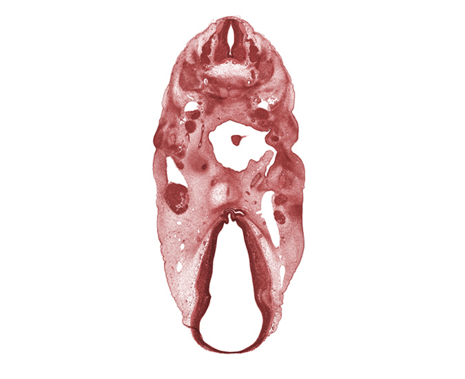 C-3 spinal nerve, C-4 spinal ganglion, abducens nerve (CN VI), adenohypophysial pouch, anterior dural venous plexus, basal plate condensation, cartilaginous vertebral centrum, dorsal thalamus, edge of tongue, epithalamus, hypoglossal nerve (CN XII), hypothalamus, internal carotid artery, mandibular nerve (CN V₃), maxillary nerve (CN V₂), missing tissue (artifact), neural arch, neurohypophyseal bud, oculomotor nerve (CN III), ophthalmic nerve (CN V₁), oronasal cavity, oropharynx, otic capsule condensation, pharyngeal pouch 1, pharyngeal pouch 2, precardinal vein, precartilage condensation of pharyngeal arch 2, spinal accessory nerve (CN XI), subthalamus, ventral thalamus