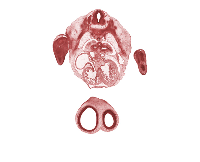 T-3 / T-4 interganglion region, aorta, atrioventricular endocardial cushion(s), frontal prominence, interventricular sulcus, junction of atrioventricular endocardial cushion and interventricular septum, left horn of sinus venosus, left ventricle, musculi pectinati in right atrial wall, peritoneal cavity, postcardinal vein, pulmogenic coat, right atrioventricular canal, right ventricle, sinus venosus, sympathetic trunk