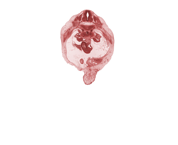 T-10 spinal ganglion, aorta, duodenum, edge of gall bladder, intermediate zone, junction of bile duct and duodenum, marginal zone, mesonephric duct, paramesonephric groove, peritoneal cavity, right lobe of liver, superior mesenteric artery, superior mesenteric vein, umbilical vein, ventricular zone