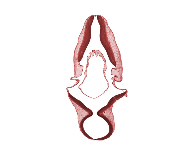 alar plate of metencephalon (cerebellum), alar plate(s), basal plate, disrupted tissue (artifact), endolymphatic duct, infolded roof plate of rhombencephalon, roof plate, sulcus limitans