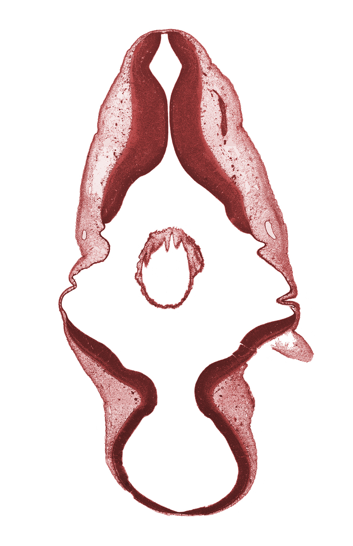 accessory nerve (CN XI), artifact separation(s), basal plate of myelencephalon, endolymphatic duct, exterior of embryo, isthmus of rhombencephalon, root of vagus nerve (CN X), sulcus limitans, trochlear nerve (CN IV)