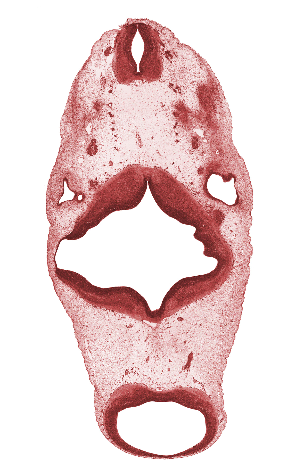 C-1 spinal ganglion, C-1 ventral root, anterior semicircular duct, cerebral peduncle, mesencoel (cerebral aqueduct), oculomotor nerve (CN III), posterior dural venous plexus, posterior semicircular duct, rhombomere 2, superior ganglion of glossopharyngeal nerve (CN IX), trochlear nerve (CN IV), vertebral artery