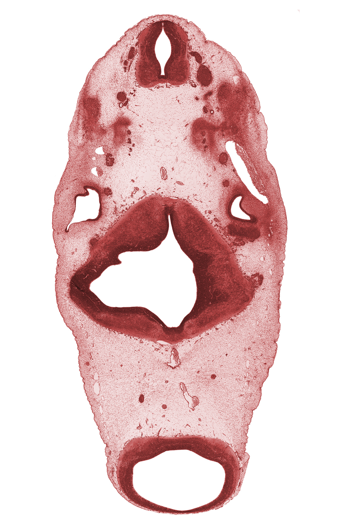 C-2 dorsal root, C-2 spinal ganglion, anterior semicircular duct, basilar artery, central canal, cerebral peduncle, dorsal fasciculus, glossopharyngeal nerve (CN IX), hypoglossal nerve (CN XII), intermediate zone, lateral semicircular duct, marginal zone, meninx, middle dural venous plexus, oculomotor nerve (CN III), posterior semicircular duct, rhombomere 3, root of facial nerve (CN VII), spinal accessory nerve (CN XI), vagus nerve (CN X), ventricular zone