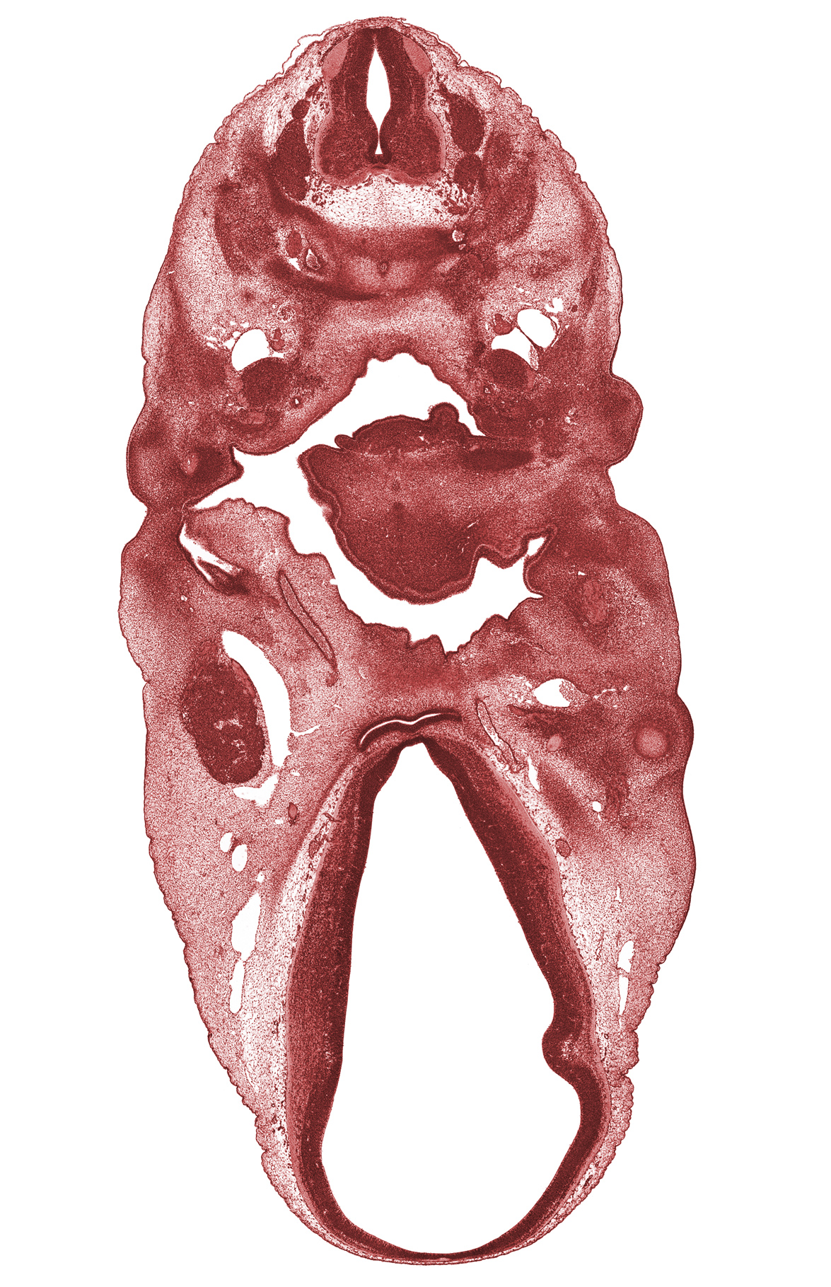 C-4 spinal ganglion, C-5 spinal ganglion, alisphenoid condensation, anterior dural venous plexus, auricular hillock, basisphenoid condensation, central canal, chorda tympani nerve, dorsal thalamus, edge of optic cup, epiglottis condensation, external acoustic meatus, hypothalamus, internal carotid artery, mandibular nerve (CN V₃), marginal ridge, maxillary vein, neural arch, oculomotor nerve (CN III), orbitosphenoid condensation, pharyngeal pouch 2, roof plate, supra-optic region, sympathetic trunk, terminal part of glossopharyngeal nerve (CN IX), vagus nerve (CN X), ventral thalamus
