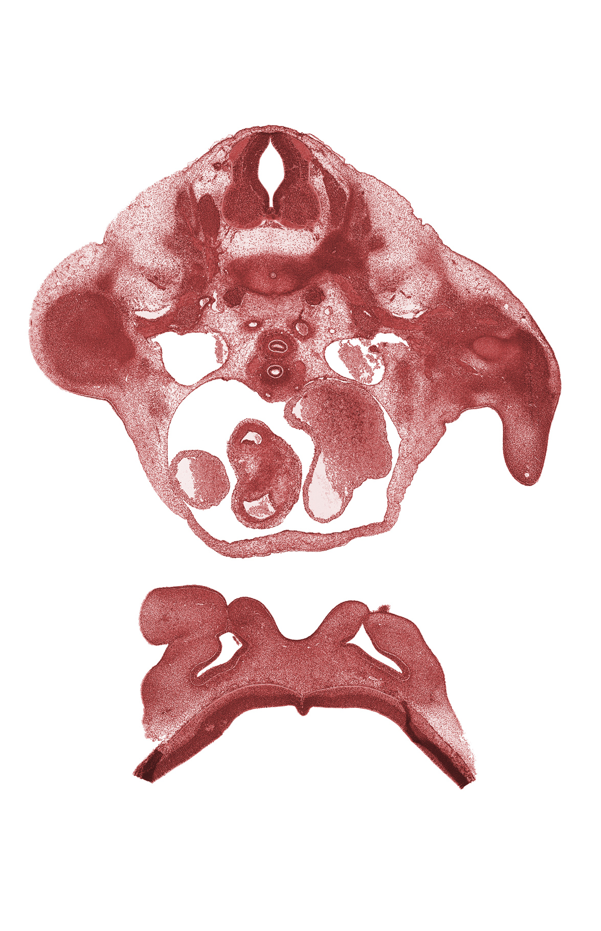 T-1 spinal ganglion, alar plate(s), arm region, ascending aorta, basal plate, esophagus endoderm, floor plate, forearm region, lumen of nasal sac, missing tissue (artifact), musculi pectinati in left atrial wall, nasomaxillary groove, right atrium, roof plate, subclavian artery, subclavian vein, sulcus limitans, trachea (endoderm)