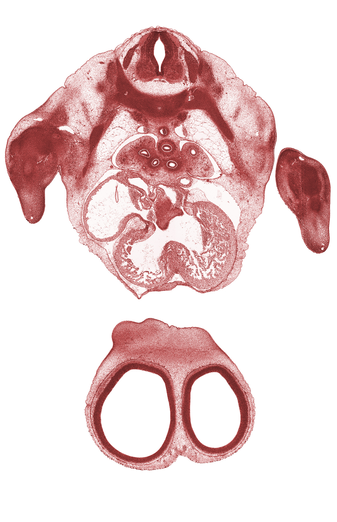 T-3 spinal ganglion, aorta, cerebral vesicle (telencephalon), dense caudal part of sclerotome, fused atrioventricular endocardial cushions, interorbital ligament, interventricular foramen, lateral ventricle, left atrioventricular canal, left atrium, left lower secondary bronchus, marginal vein, nasofrontal groove (interorbital groove), neural arch, pericardial cavity, rib 3, right atrioventricular canal, right atrium, sinus venosus