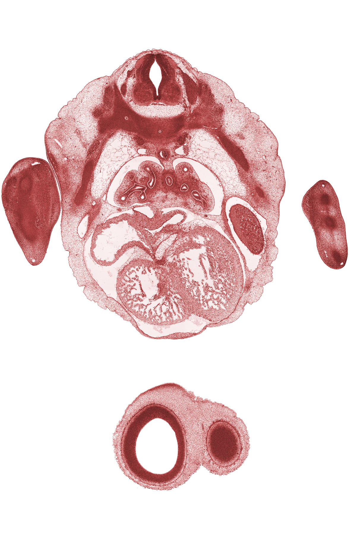 T-4 spinal ganglion, aorta, cerebral vesicle (telencephalon), edge of peritoneal cavity, esophagus, hand plate, inferior vena cava, intermediate zone, junction of left sinus horn and sinus venosus, left horn of sinus venosus, left lobe of liver, marginal zone, middle secondary bronchus, postcardinal vein, rib 4, tertiary bronchopulmonary buds in lower lobe of left lung