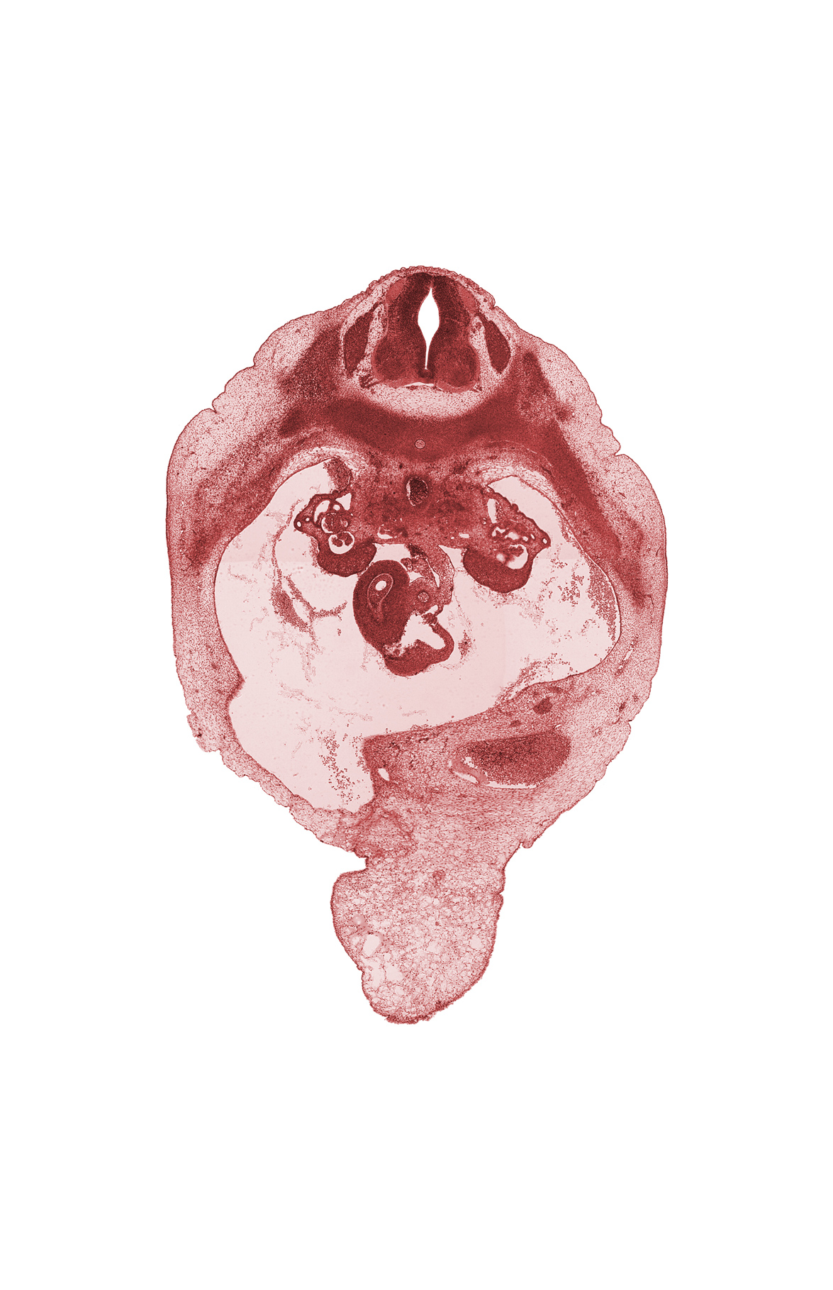 T-10 spinal ganglion, amnion on surface of umbilical cord, dense caudal part of sclerotome, duodenum, intercostal muscle(s), peritoneal cavity, rib 11, superior mesenteric artery, superior mesenteric vein, surface ectoderm, umbilical vein