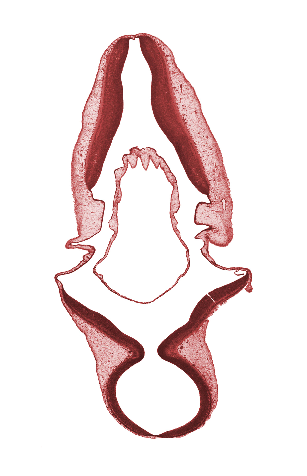 alar plate of metencephalon (cerebellum), alar plate(s), basal plate, disrupted tissue (artifact), endolymphatic duct, infolded roof plate of rhombencephalon, roof plate, sulcus limitans