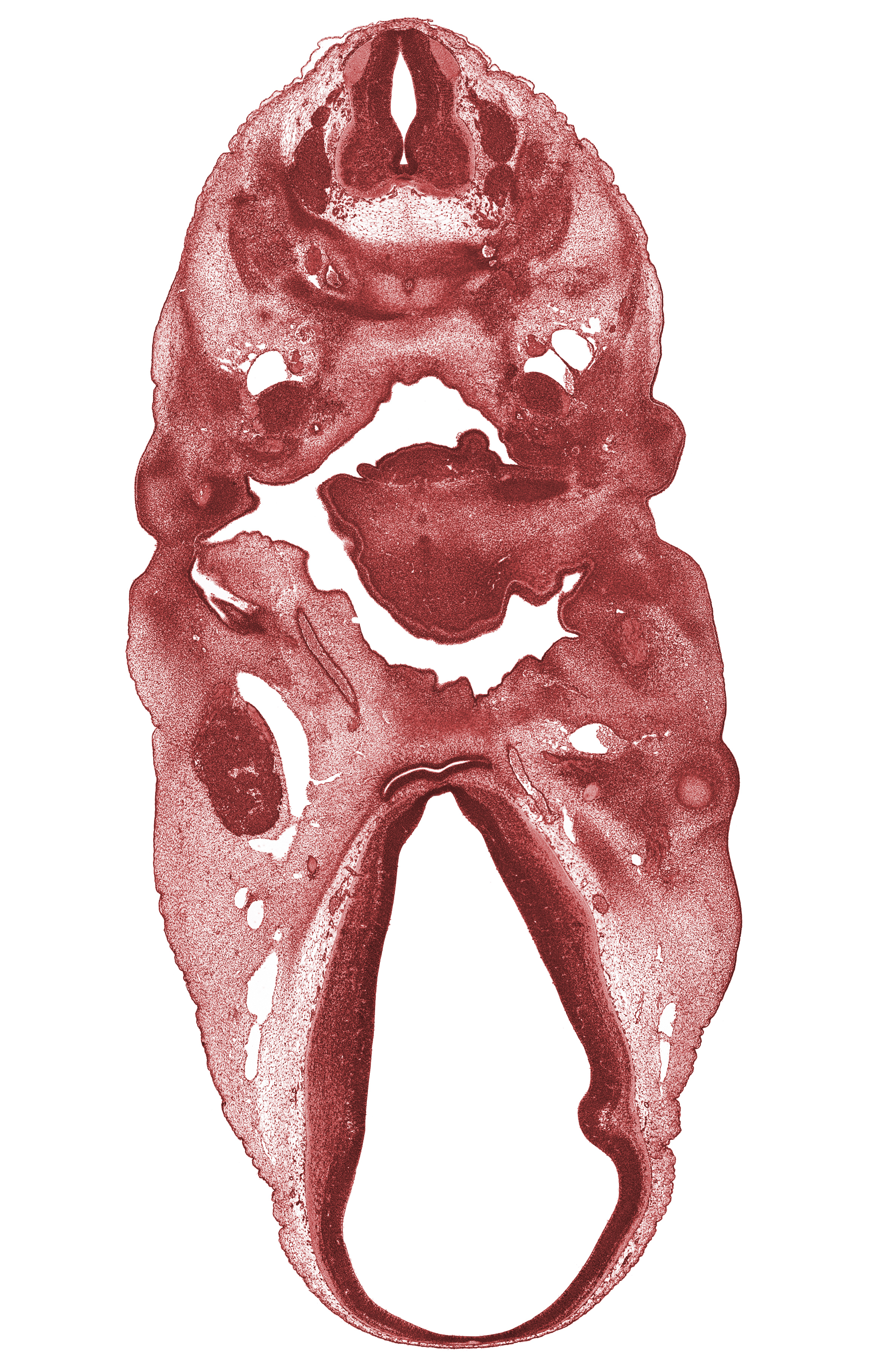 C-4 spinal ganglion, C-5 spinal ganglion, alisphenoid condensation, anterior dural venous plexus, auricular hillock, basisphenoid condensation, central canal, chorda tympani nerve, dorsal thalamus, edge of optic cup, epiglottis condensation, external acoustic meatus, hypothalamus, internal carotid artery, mandibular nerve (CN V₃), marginal ridge, maxillary vein, neural arch, oculomotor nerve (CN III), orbitosphenoid condensation, pharyngeal pouch 2, roof plate, supra-optic region, sympathetic trunk, terminal part of glossopharyngeal nerve (CN IX), vagus nerve (CN X), ventral thalamus