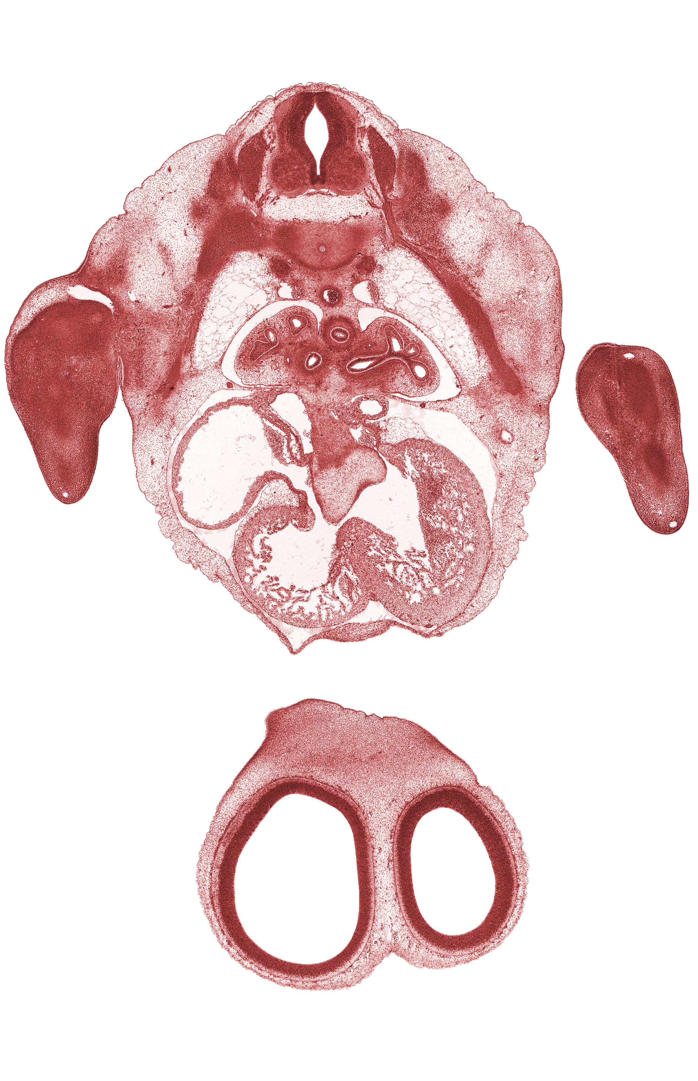 T-2 spinal nerve, T-3 intercostal nerve, T-3 spinal ganglion, central canal, edge of interventricular foramen, edge of peritoneal cavity, forearm region, hand plate, heart prominence, left atrioventricular canal, muscular part of interventricular septum, pleural cavity, right atrioventricular canal, right atrium, sinus venosus, tertiary bronchopulmonary buds in lower lobe of left lung