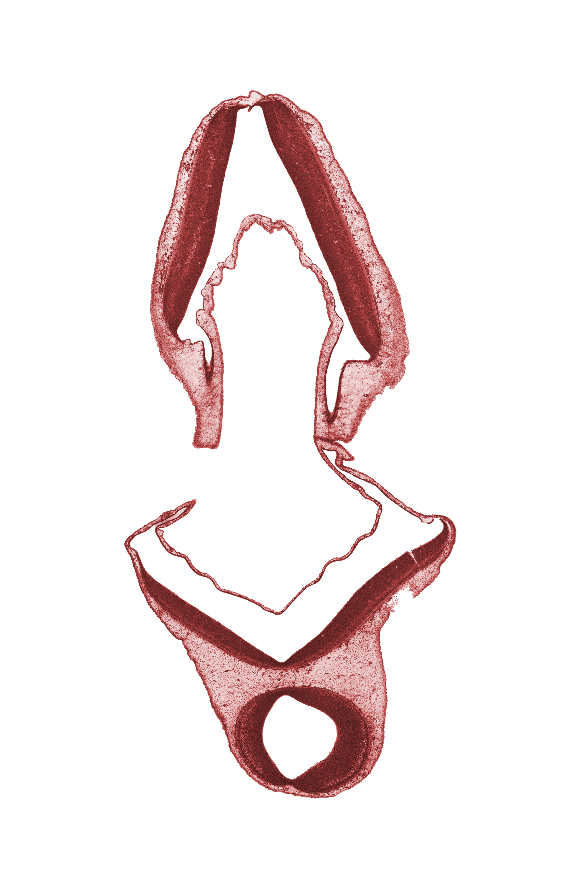 alar plate(s), continuity of surface ectoderm, mesencephalon (M2), mesencoel (cerebral aqueduct), myelencephalon, roof plate, vascular plexus