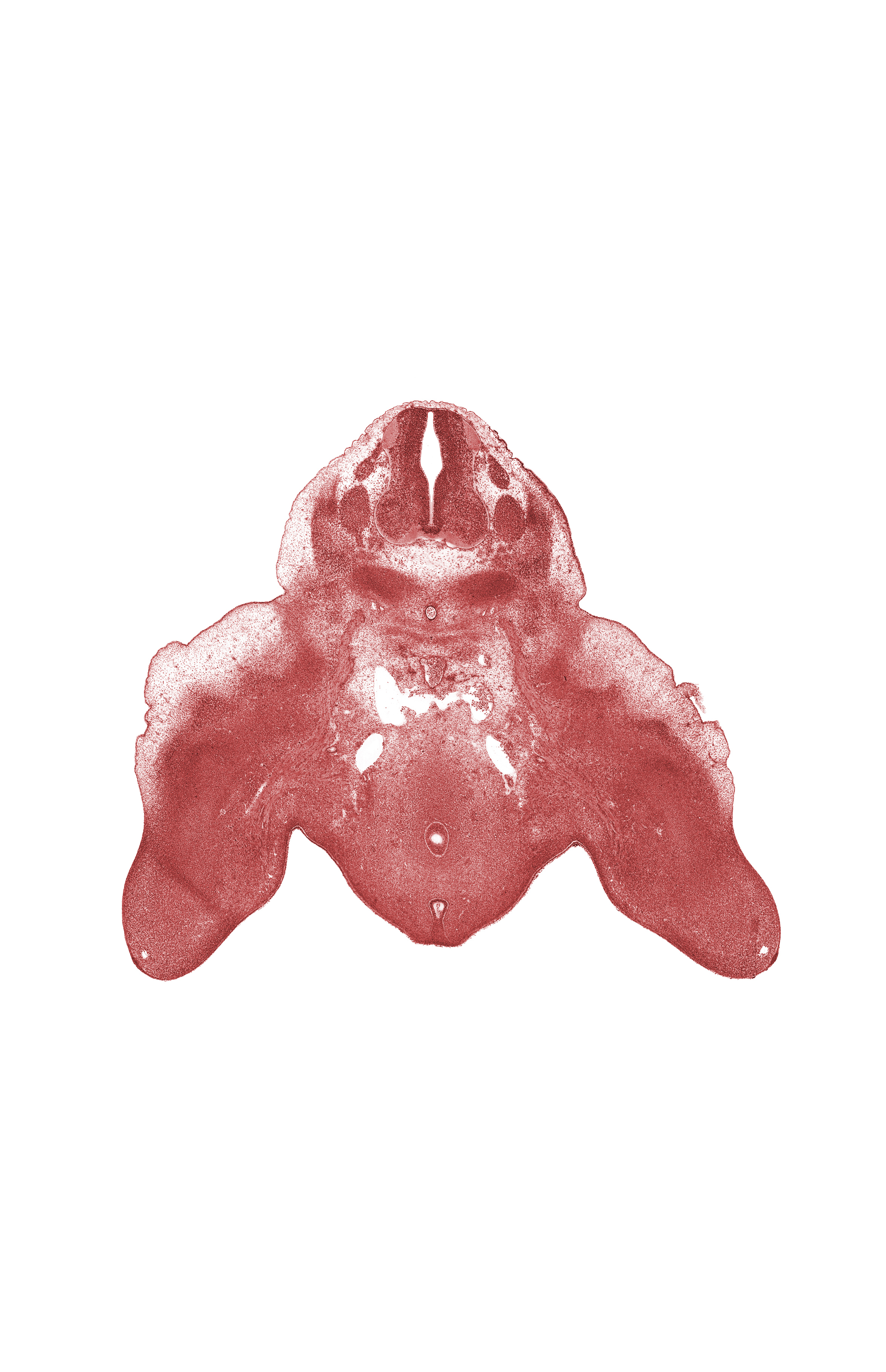 L-3 spinal ganglion, L-4 spinal ganglion, femoral artery, labioscrotal swelling, lumbar plexus, marginal vein, median sacral artery, postcardinal vein anastomosis, rectum endoderm, skeletal blastema of fibula, skeletal blastema of tibia, sympathetic trunk, urethral fold, urethral groove, urorectal septum