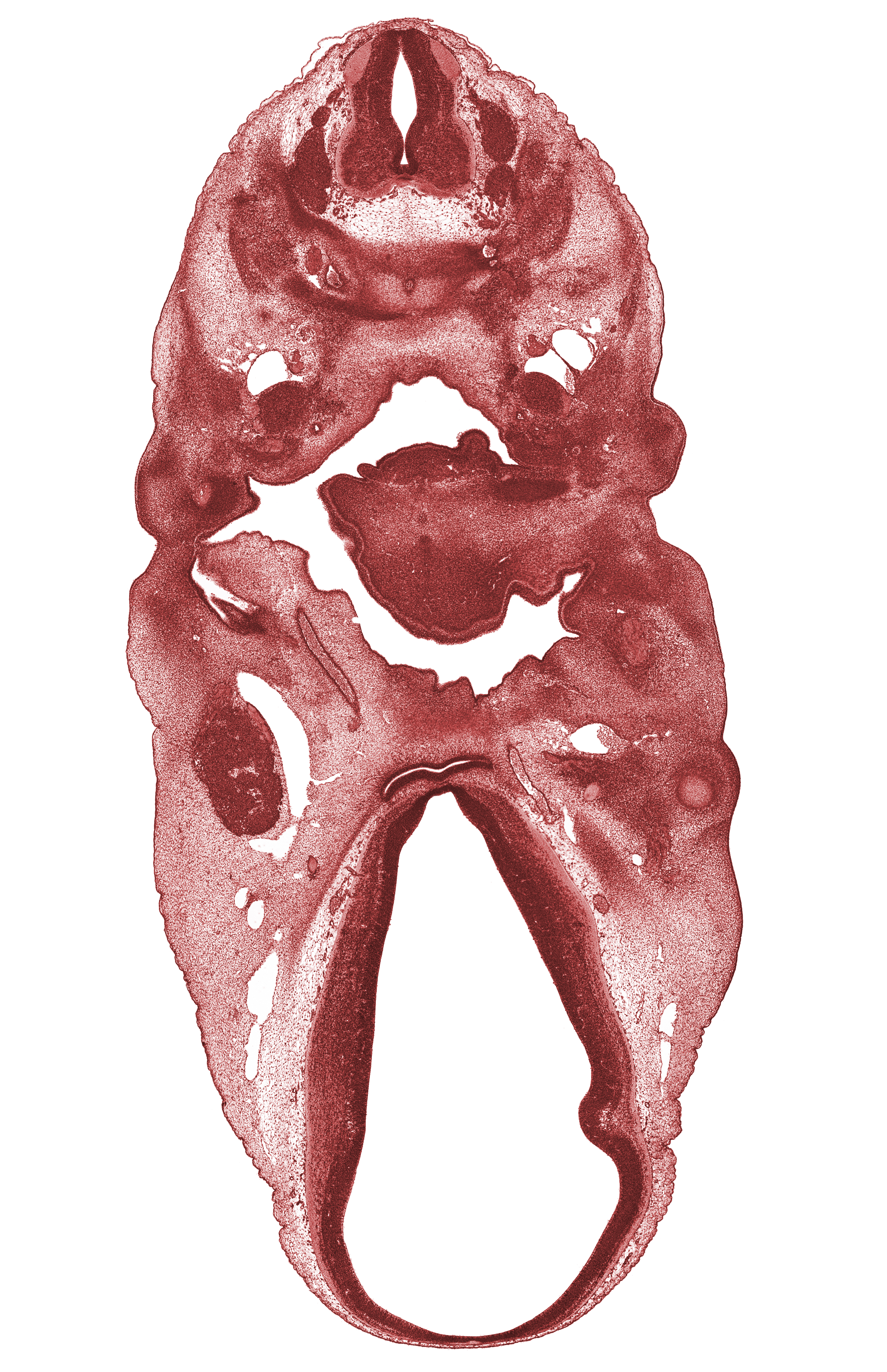 C-4 spinal ganglion, C-5 spinal ganglion, alisphenoid condensation, anterior dural venous plexus, auricular hillock, basisphenoid condensation, central canal, chorda tympani nerve, dorsal thalamus, edge of optic cup, epiglottis condensation, external acoustic meatus, hypothalamus, internal carotid artery, mandibular nerve (CN V₃), marginal ridge, maxillary vein, neural arch, oculomotor nerve (CN III), orbitosphenoid condensation, pharyngeal pouch 2, roof plate, supra-optic region, sympathetic trunk, terminal part of glossopharyngeal nerve (CN IX), vagus nerve (CN X), ventral thalamus