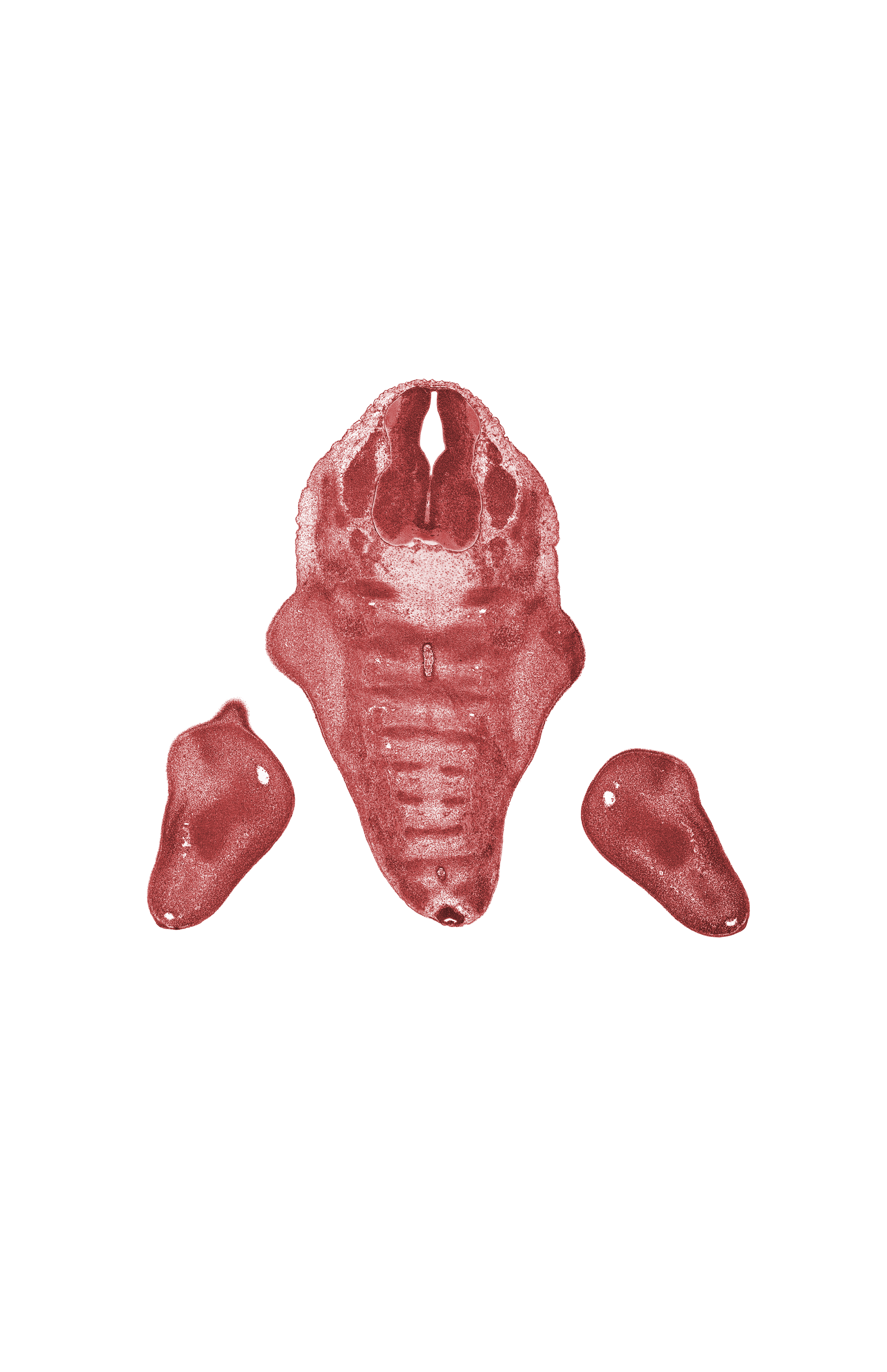 L-5 spinal ganglion, S-1 spinal ganglion, S-1 spinal nerve, S-2 spinal nerve, buttox region, coccygeal sclerotome, filum terminale, foot region, notochord