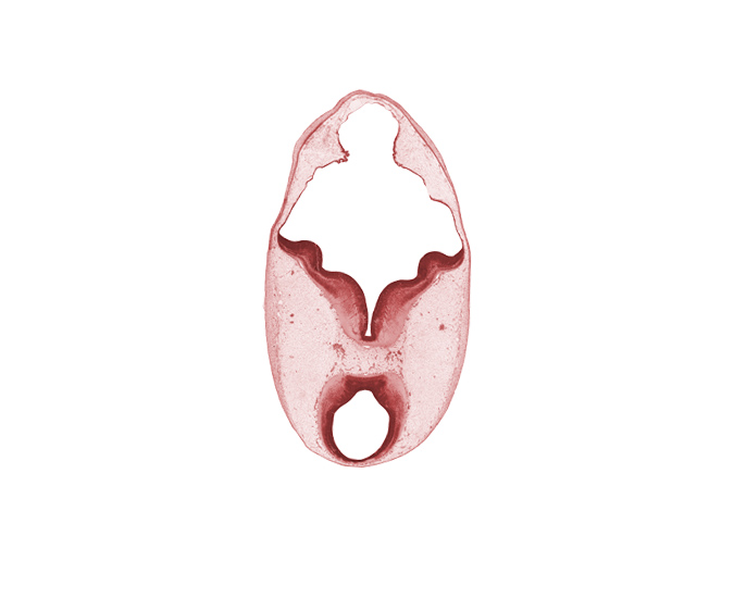 cerebral aqueduct (mesencoel), median sulcus, mesencephalon (M2), metencephalon, rhombencoel (fourth ventricle), root of oculomotor nerve (CN III), sulcus limitans