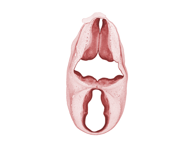 alar plate(s), basal plate, decussation, marginal ridge, oculomotor nerve (CN III), rhombencoel (fourth ventricle), roof plate, subarachnoid space, sulcus limitans, trochlear nerve (CN IV)