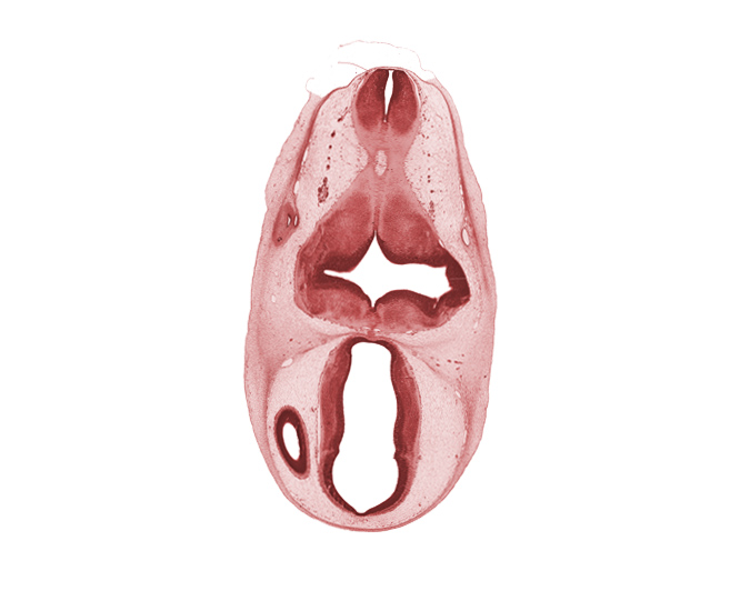 dorsal sulcus, dorsal thalamus, edge of lateral ventricle, endolymphatic sac, epithalamus, hypothalamus, intermediate zone, marginal ridge, marginal zone, otic capsule, pyramidal tract region, rhombencoel (fourth ventricle), third ventricle, ventral thalamus, ventricular zone