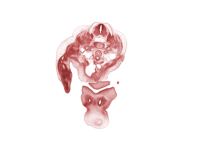 C-5 / C-6 intervertebral disc, C-5 ventral primary ramus, C-6 spinal ganglion, C-6 spinal nerve, brachiocephalic artery, cephalic edge of upper limb, chin, common carotid artery, deltoid muscle, dorsal root(s), edge of pericardial cavity, esophagus endoderm, frontal prominence, interorbital groove, lateral nasal prominence, maxillary prominence of pharyngeal arch 1, nasomaxillary groove, primary palate, subclavian artery, thymus gland, trachea (endoderm), trapezius muscle