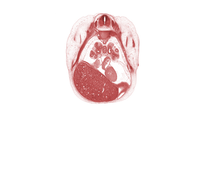 T-5 intercostal nerve, T-5 spinal ganglion, central tendon of diaphragm, edge of diaphragm, head of rib 6, inferior vena cava, left atrium, left ventricle, lower lobe of left lung, lower lobe of right lung, lower secondary bronchus of left lung, lower secondary bronchus of right lung, medial tertiary bronchus of right lung, middle lobe of right lung, oblique fissure, rib 6, right postcardinal vein (azygos vein), subarachnoid space, sympathetic trunk