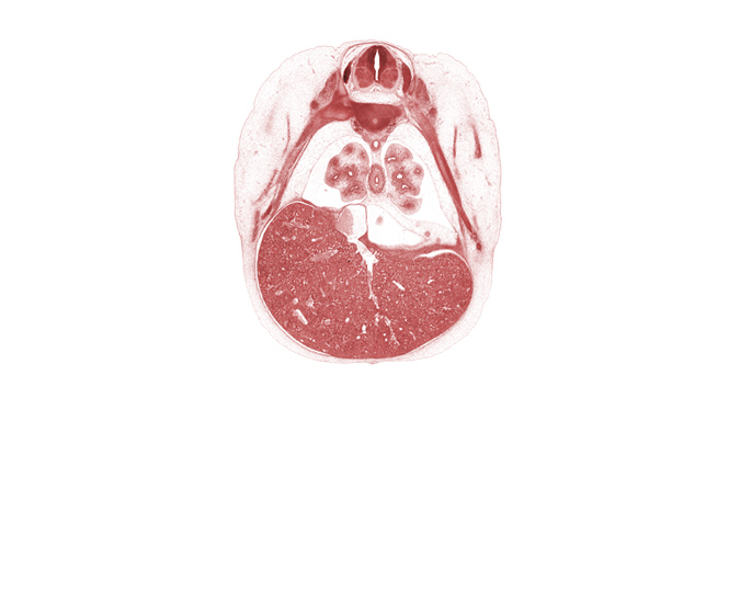 C-6 / C-7 intervertebral disc, T-6 intercostal nerve, T-6 spinal ganglion, T-6 spinal nerve, blastemata of deep back muscles, dorsal meso-esophagus, efferent hepatic veins, inferior vena cava, left lobe of liver, lingula of upper lobe of left lung, liver prominence, lower lobe of left lung, lower lobe of right lung, oblique fissure, pericardial cavity, peritoneal cavity, rib 7, rib 8, right lobe of liver