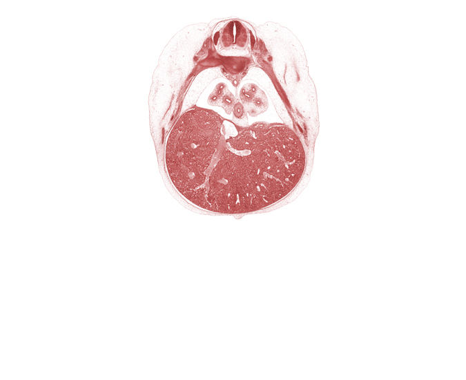 T-7 / T-8 intervertebral disc, T-7 intercostal nerve, T-7 spinal ganglion, blastemata of deep back muscles, efferent hepatic veins, esophagus, inferior vena cava, liver prominence, lower lobe of left lung, notochord, osteogenic layer, peritoneal cavity, pleural cavity, pleuroperitoneal membrane, rib 7, rib 8, sympathetic trunk, umbilical cord