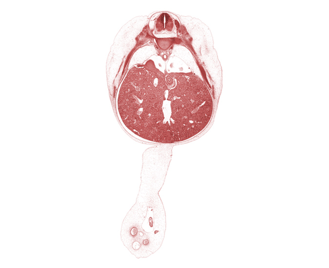 T-8 spinal ganglion, caudal edge of left lung, ductus venosus, esophagus, head of rib 9, inferior vena cava, lung, right, mucoid connective tissue in umbilical cord, omphalomesenteric artery, peritoneal cavity, postcardinal vein, rib 10, rib 9, suprarenal gland cortex, umbilical coelom