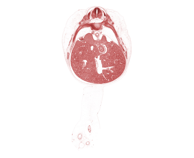 T-8 spinal ganglion, afferent hepatic vein, aorta, cephalic edge of mesonephros, cephalic edge of suprarenal gland, ductus venosus, inferior vena cava, junction of esophagus and stomach, omphalomesenteric artery, peritoneal cavity, rib 10, rib 9, sympathetic trunk, umbilical coelom