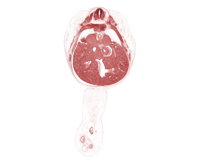 T-8 / T-9 interganglion region, T-9 / T-10 intervertebral disc, T-9 intercostal nerve, afferent hepatic vein, amnion on surface of umbilical cord, aorta, blastemata of deep back muscles, ductus venosus, falciform ligament, inferior vena cava, junction of esophagus and stomach, left lobe of liver, omphalomesenteric artery, rib 10, rib 11, right lobe of liver, sympathetic trunk, umbilical coelom