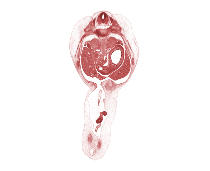 T-10 spinal ganglion, aorta, bile duct, cephalic edge of gonadal ridge, cystic duct, distal limb of herniated midgut, greater curvature of stomach, greater splanchnic nerve, head of rib 11, hepatic portal vein, inferior vena cava, junction of peritoneal cavity and umbilical coelom, lesser curvature of stomach, omphalomesenteric artery, proper hepatic artery, superior mesenteric artery, umbilical coelom, umbilical vein