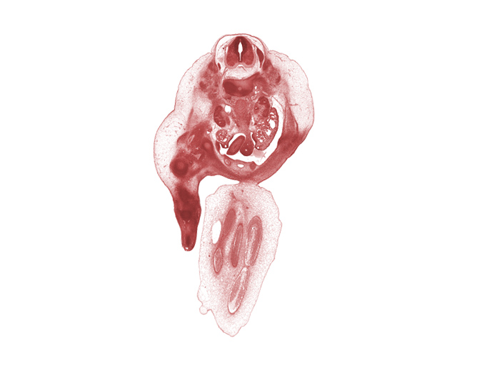 L-1 spinal ganglion, aorta, blastemata of abdominal wall muscles, blastemata of deep back muscles, blastemata of leg muscles, caudal edge of junction of abdominal wall and umbilical cord, caudal edge of ovary, hilum of kidney (metanephros), hindgut, inferior mesenteric artery, inferior vena cava, kidney (metanephros), left umbilical artery, marginal vein, mesonephric duct, mesonephric glomerulus, right umbilical artery, umbilical vein, urinary bladder