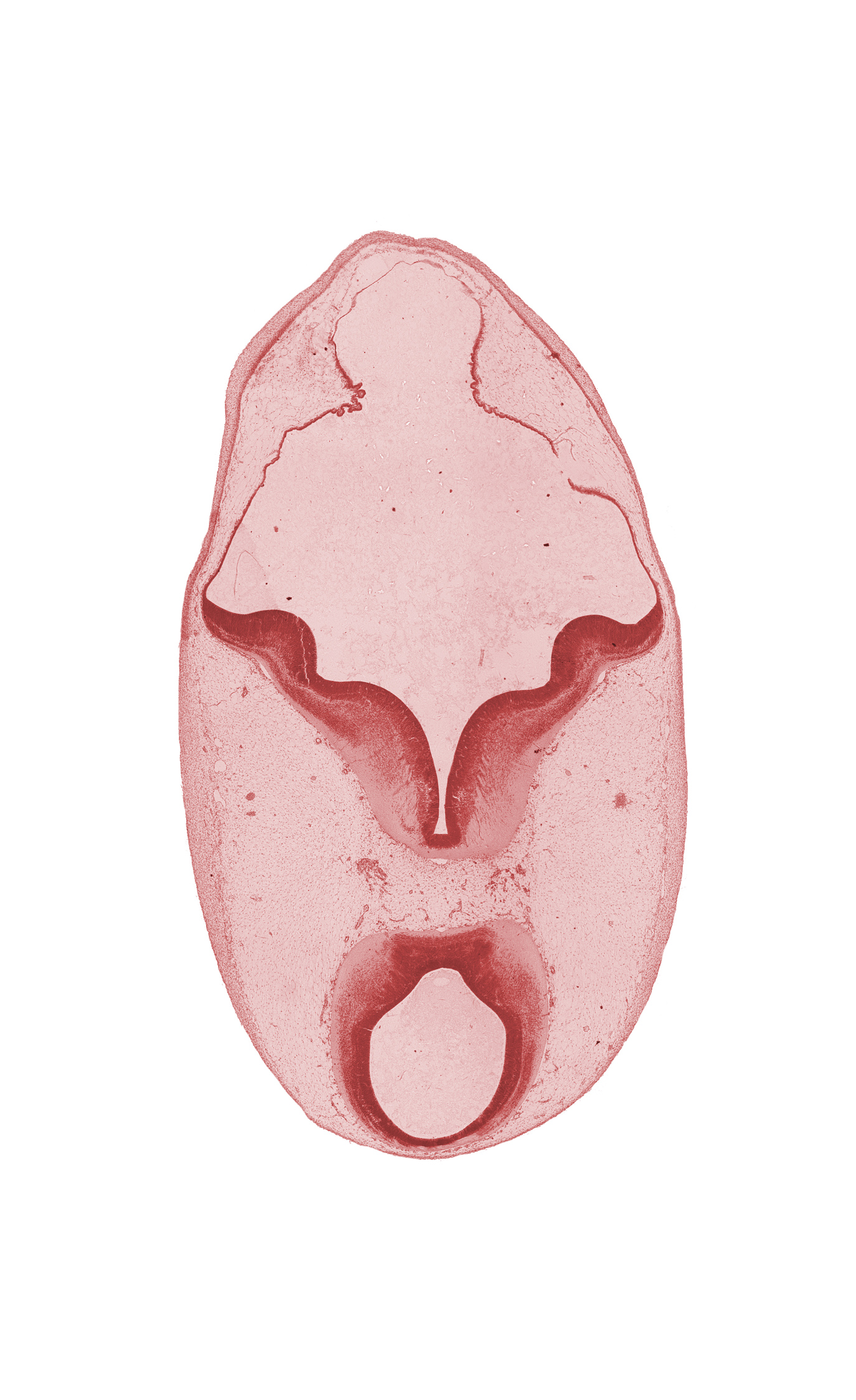 cerebral aqueduct (mesencoel), median sulcus, mesencephalon (M2), metencephalon, rhombencoel (fourth ventricle), root of oculomotor nerve (CN III), sulcus limitans