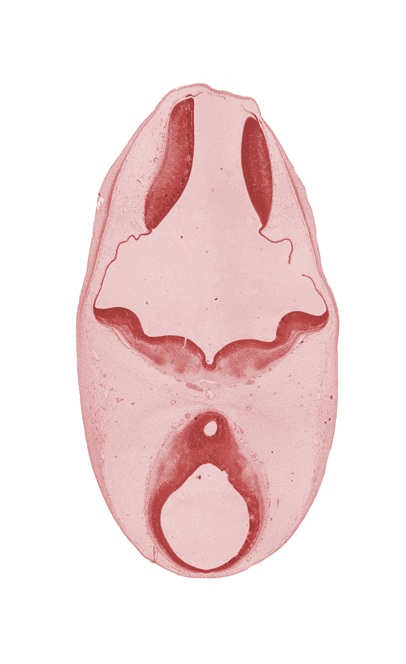 artifact separation(s), diencephalon, edge of third ventricle, oculomotor nerve (CN III), roof plate, sulcus limitans, third ventricle, trochlear nerve (CN IV)