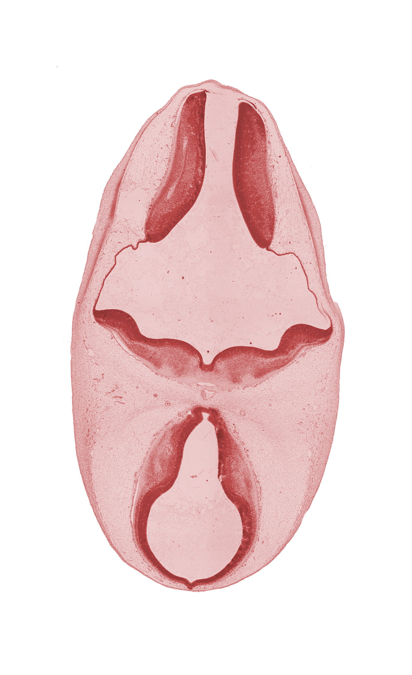 alar plate of metencephalon (cerebellum), artifact separation(s), basilar artery, basilar pons, mamillary recess, oculomotor nerve (CN III), pineal bud, rhombencoel (fourth ventricle), roof plate, third ventricle, trochlear nerve (CN IV)