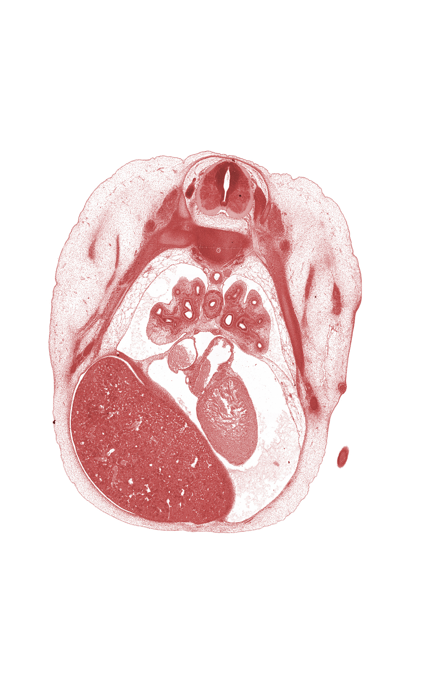 T-5 / T-6 intervertebral disc, T-5 dorsal primary ramus, T-5 intercostal nerve, T-5 spinal ganglion, aorta, apex of left ventricle, caudal edge of hand, inferior vena cava, lower lobe of left lung, lower lobe of right lung, lower secondary bronchus of left lung, lower secondary bronchus of right lung, mammary gland, middle lobe of right lung, middle secondary bronchus of right lung, oblique fissure, rib 5, rib 6, right lobe of liver, subarachnoid space, upper lobe of left lung