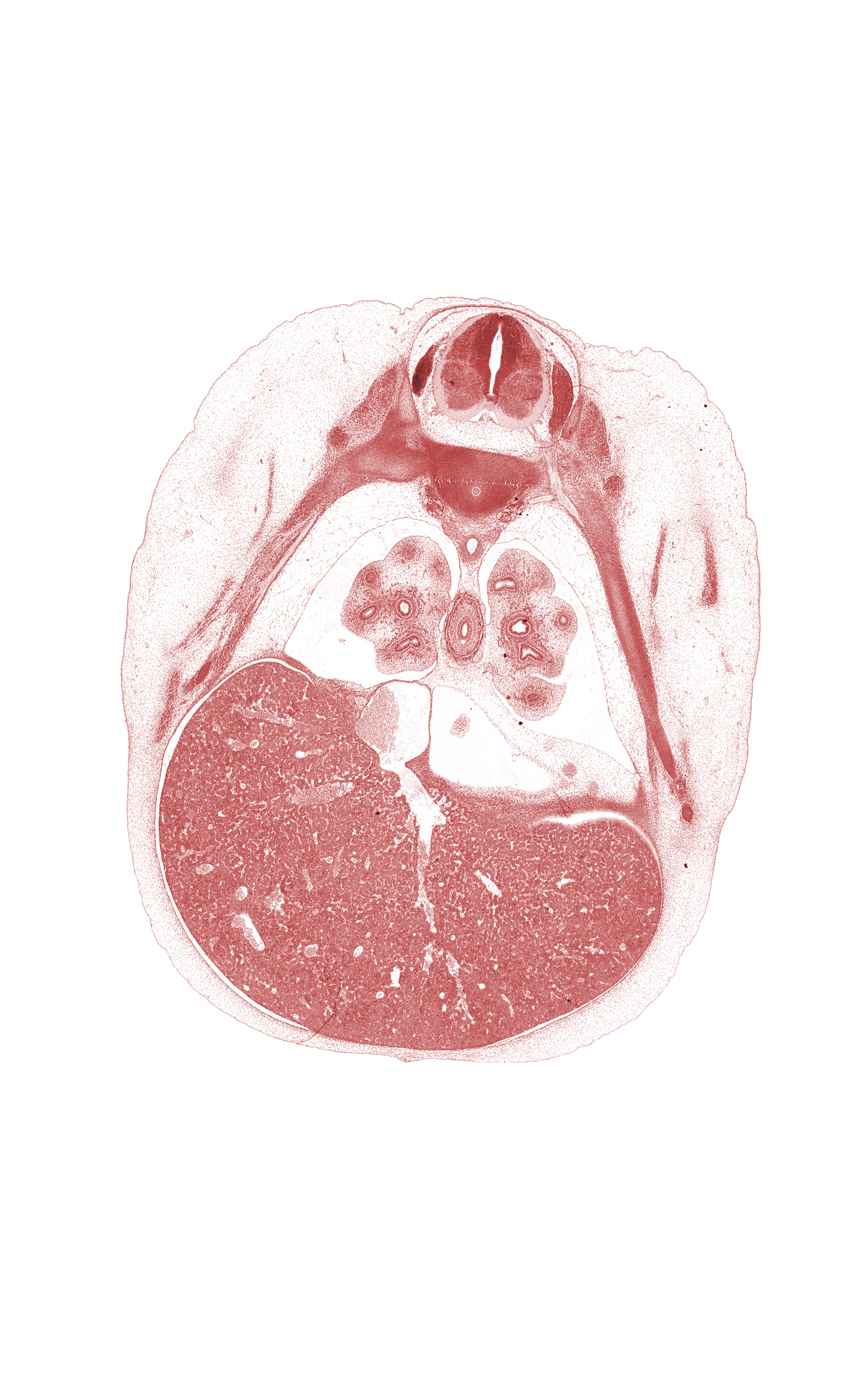 C-6 / C-7 intervertebral disc, T-6 intercostal nerve, T-6 spinal ganglion, T-6 spinal nerve, blastemata of deep back muscles, dorsal meso-esophagus, efferent hepatic veins, inferior vena cava, left lobe of liver, lingula of upper lobe of left lung, liver prominence, lower lobe of left lung, lower lobe of right lung, oblique fissure, pericardial cavity, peritoneal cavity, rib 7, rib 8, right lobe of liver