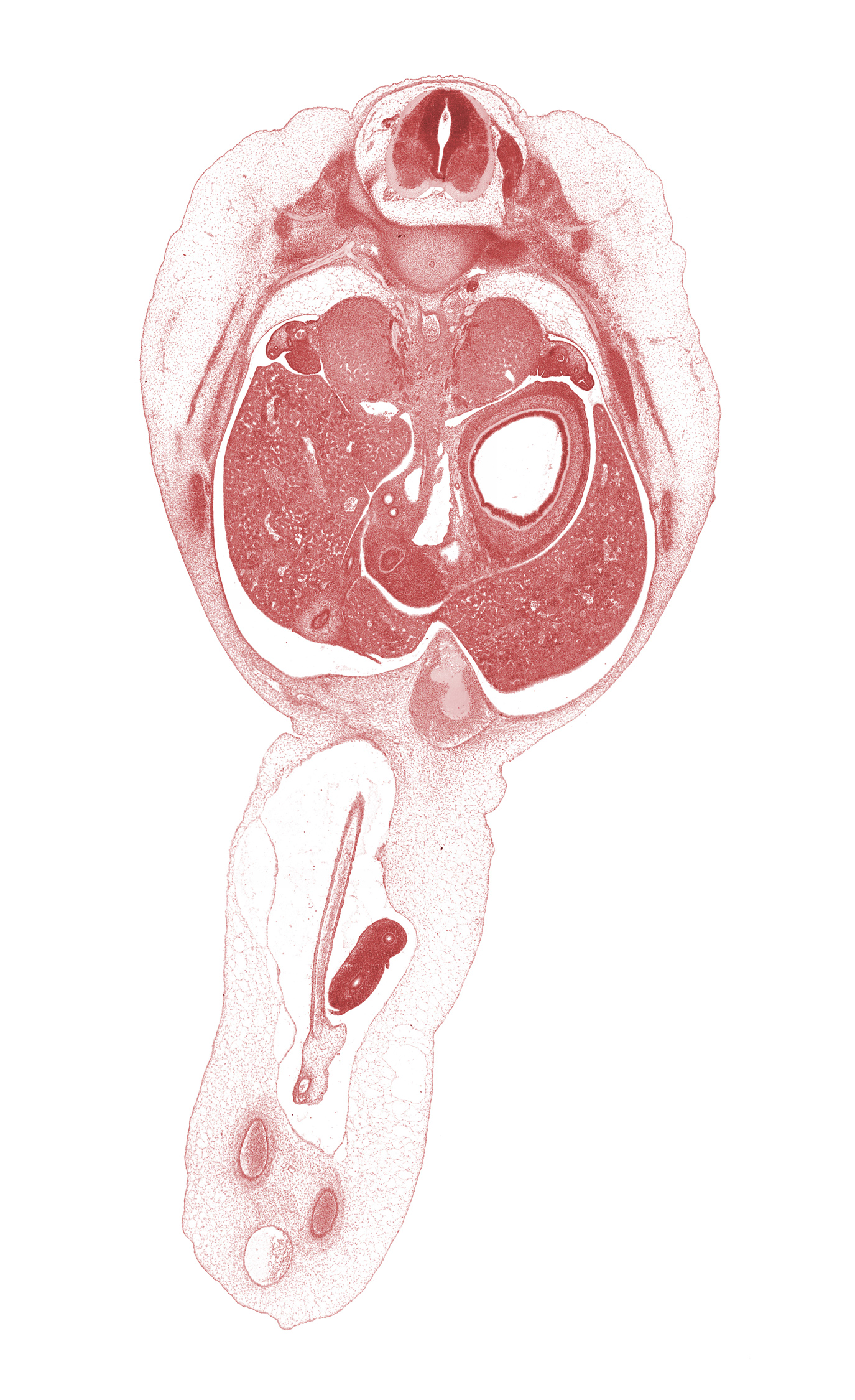 T-10 intercostal nerve, T-10 spinal ganglion, allantois, aorta, distal limb of herniated midgut, edge of superior mesenteric artery, gall bladder, hepatic portal vein, intermediate zone, left lobe of liver, left umbilical artery, lesser sac (omental bursa), lumen of body of stomach, marginal zone, mesonephric duct, omphalomesenteric artery, rectus abdominis muscle, rib 11, right lobe of liver, right umbilical artery, splenic vessels, suprarenal gland cortex, sympathetic trunk, umbilical coelom, umbilical vein, ventricular zone