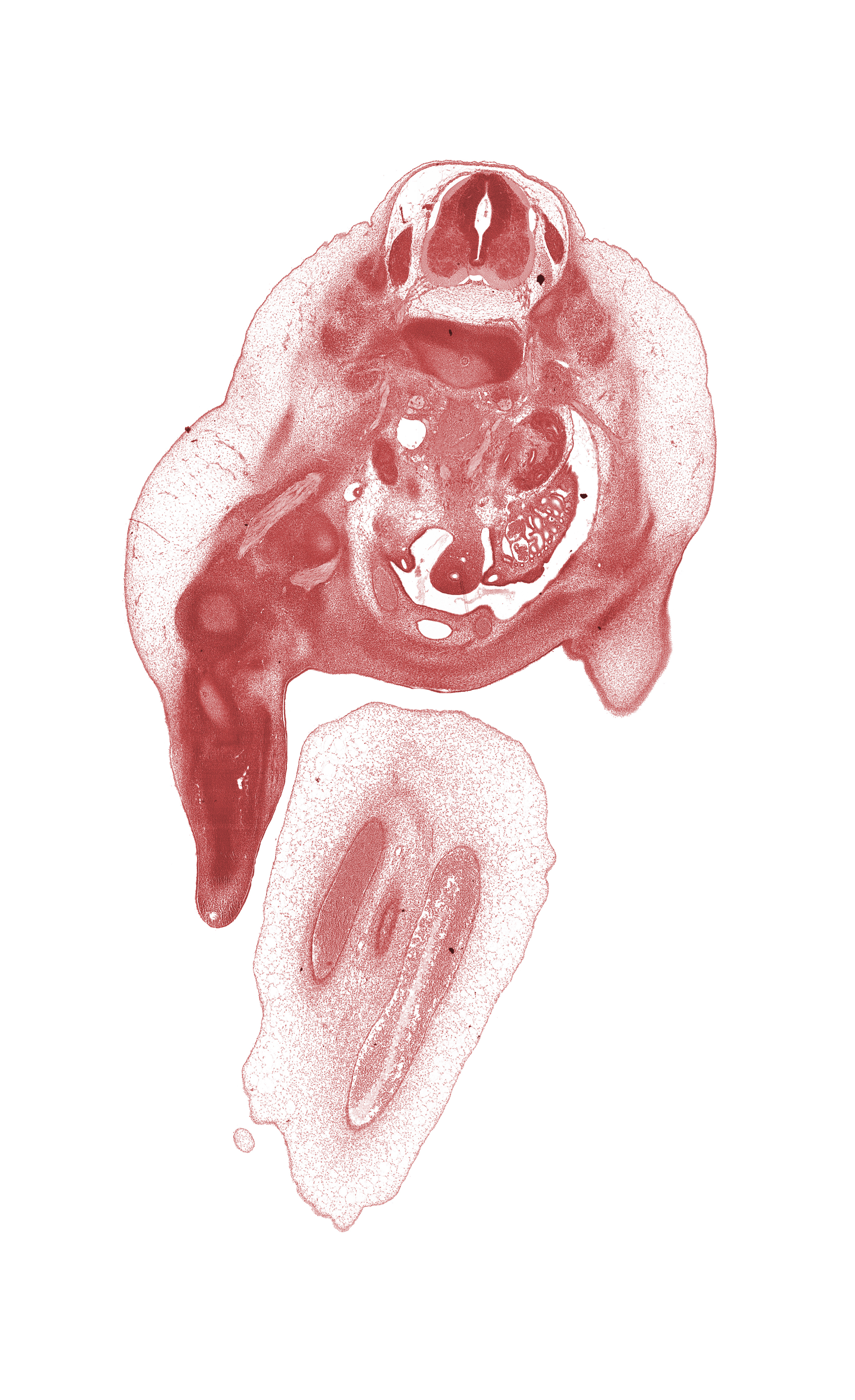 L-1 / L-2 intervertebral disc, L-1 spinal ganglion, blastemata of deep back muscles, caudal edge of kidney (metanephros), edge of anterior thigh, edge of left umbilical artery, femoral nerve, hindgut, inferior mesenteric artery, infra-umbilical part of anterior abdominal wall, kidney (metanephros), mesonephric duct, mesonephros, peritoneal cavity, right umbilical artery, umbilical vein, urinary bladder