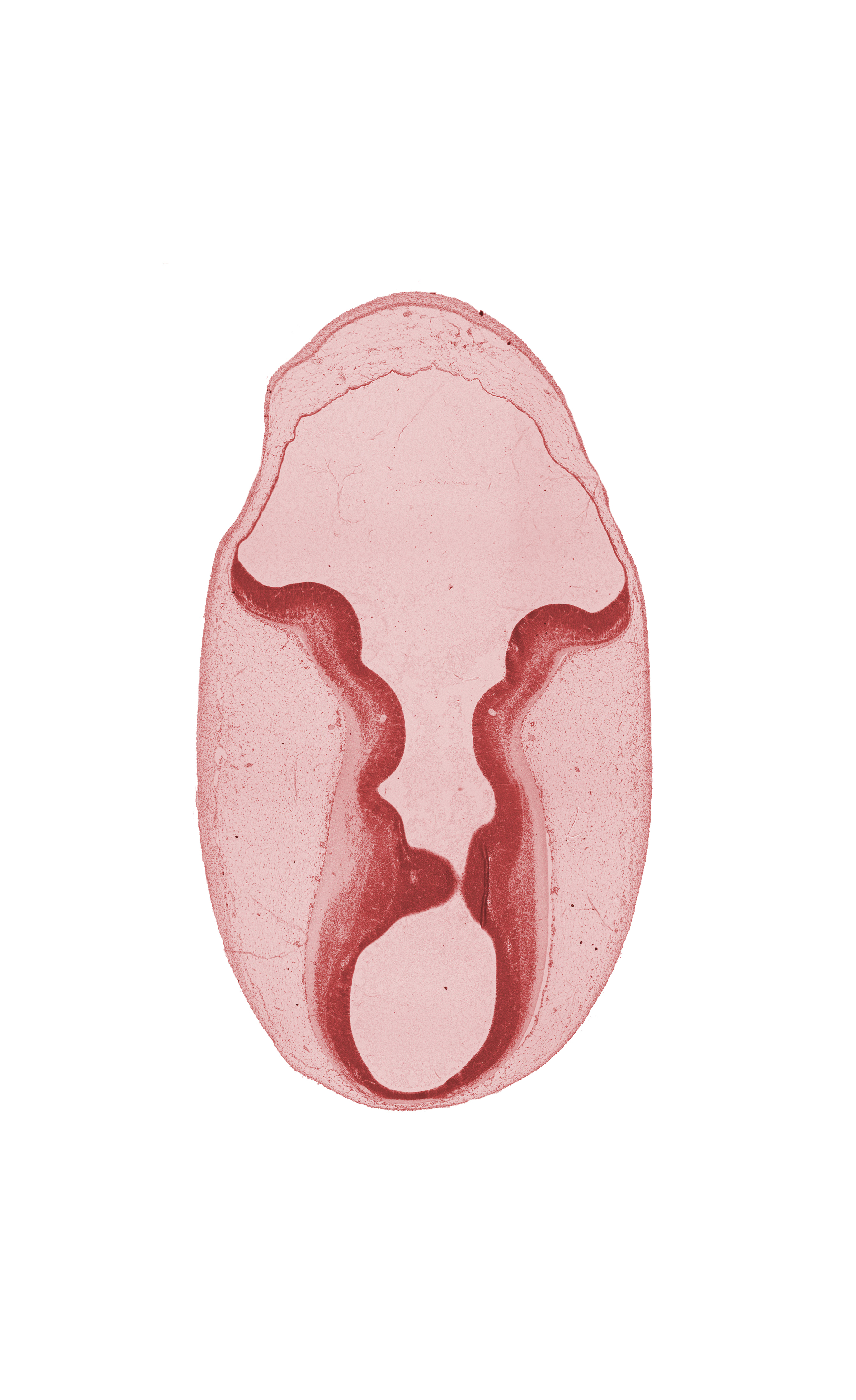 head mesenchyme, mesencephalon (M2), metencephalon, osteogenic layer, surface ectoderm, trochlear nerve (CN IV)