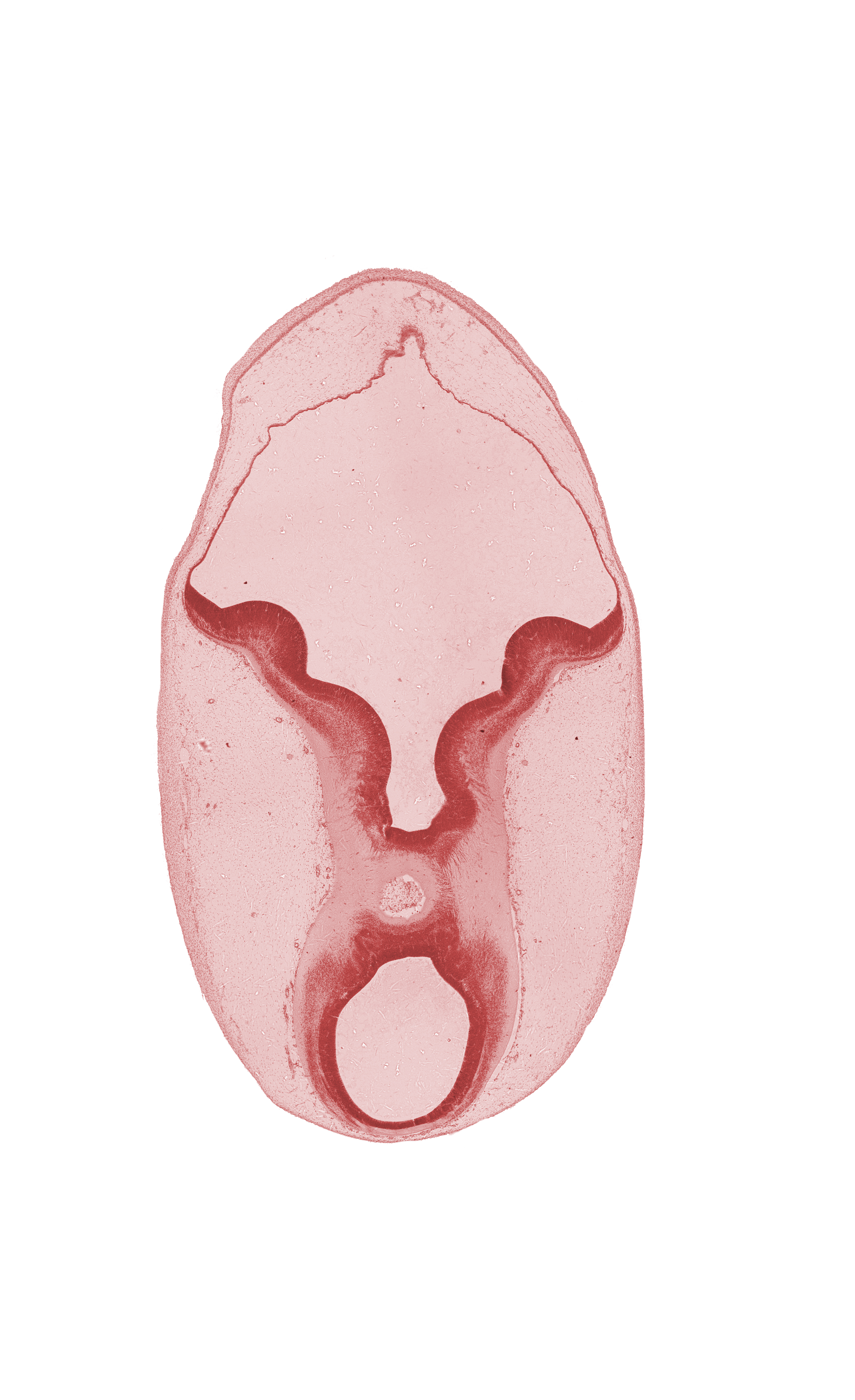 cerebral peduncle, commissure, edge of diverticulum of rhombencoel (fourth ventricle), intermediate zone, interpeduncular fossa, isthmic recess, junction of mesencephalon and metencephalon, marginal zone, osteogenic layer, rhombencoel (fourth ventricle), sulcus limitans, trochlear nerve (CN IV), ventricular zone