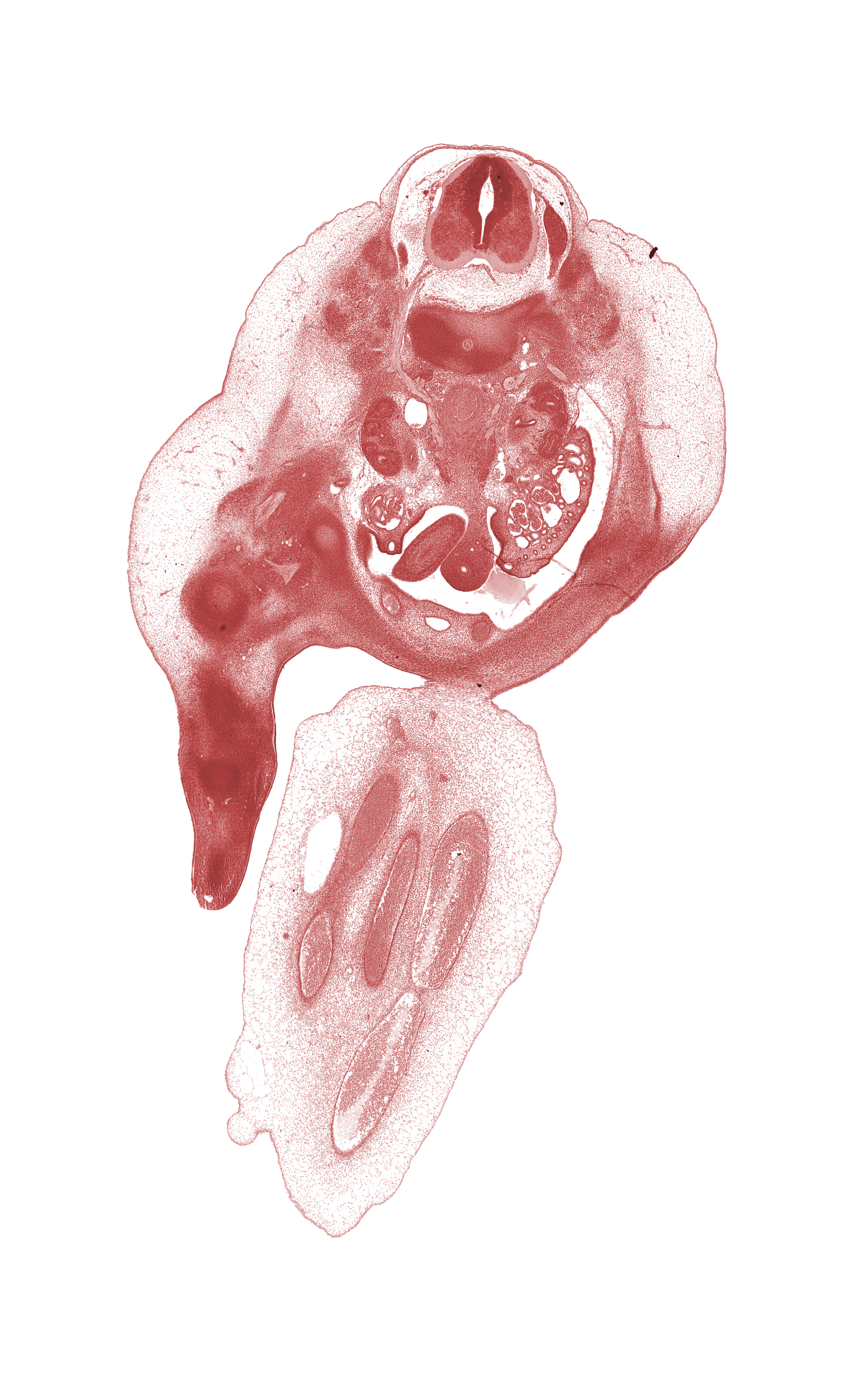 L-1 spinal ganglion, aorta, blastemata of abdominal wall muscles, blastemata of deep back muscles, blastemata of leg muscles, caudal edge of junction of abdominal wall and umbilical cord, caudal edge of ovary, hilum of kidney (metanephros), hindgut, inferior mesenteric artery, inferior vena cava, kidney (metanephros), left umbilical artery, marginal vein, mesonephric duct, mesonephric glomerulus, right umbilical artery, umbilical vein, urinary bladder