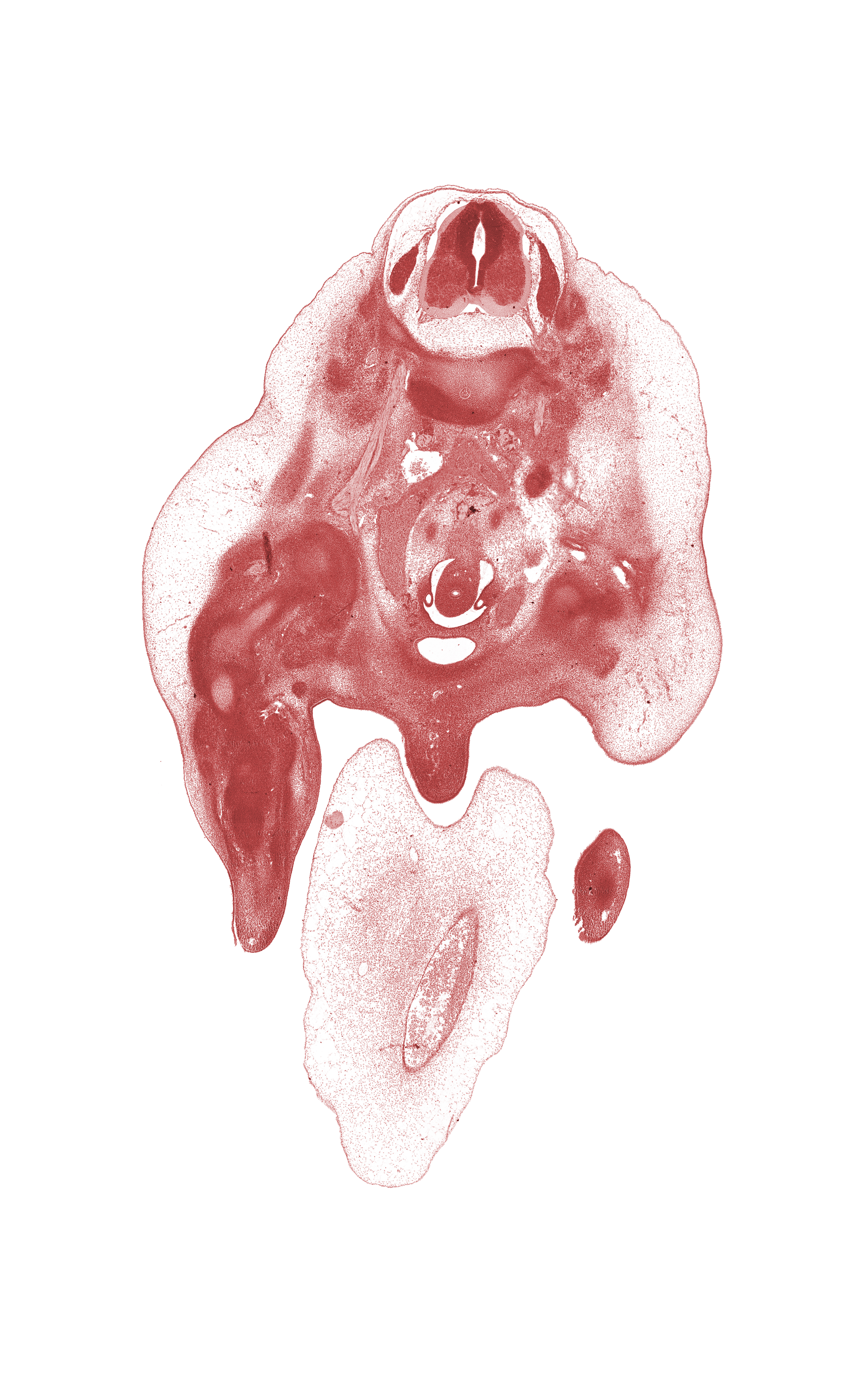 L-2 spinal ganglion, aortic bifurcation, caudal edge of kidney (metanephros), external iliac artery, femur, glans clitoris, hindgut, inferior vena cava, left ureter, marginal vein, mesonephric duct, primordial phallus, right common iliac artery, right ureter, subarachnoid space, umbilical cord, umbilical vein, urinary bladder